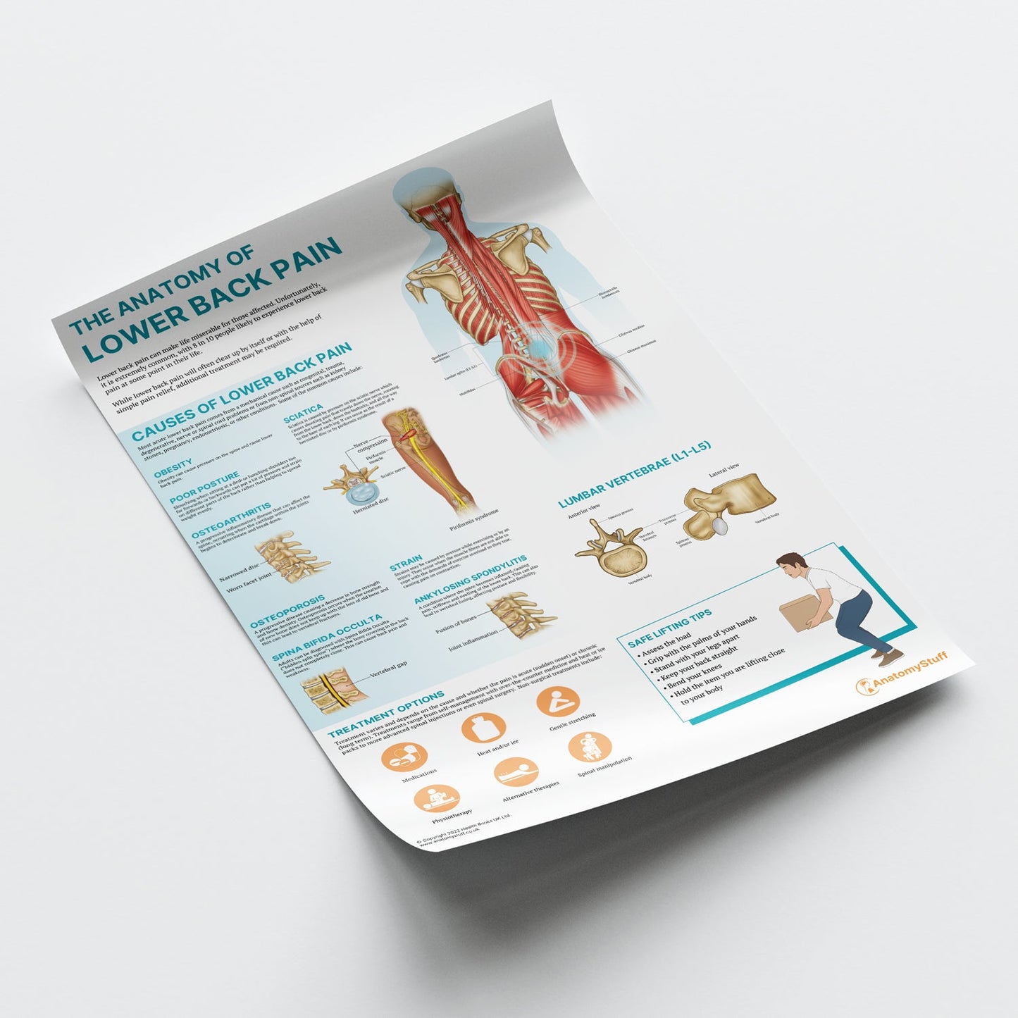 The Anatomy of Lower Back Pain Chart / Poster - Part of Collection