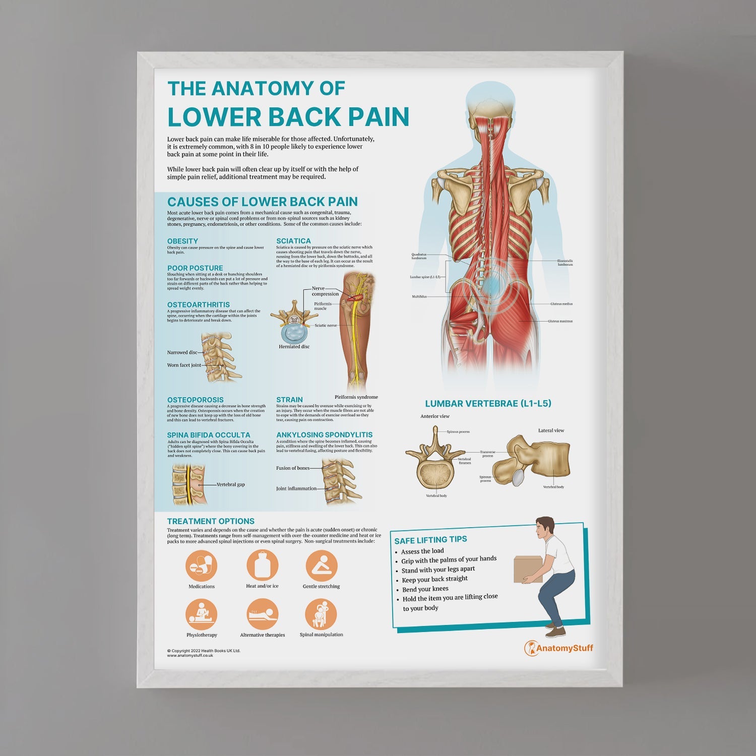 The Anatomy of Lower Back Pain Chart / Poster - Part of Collection