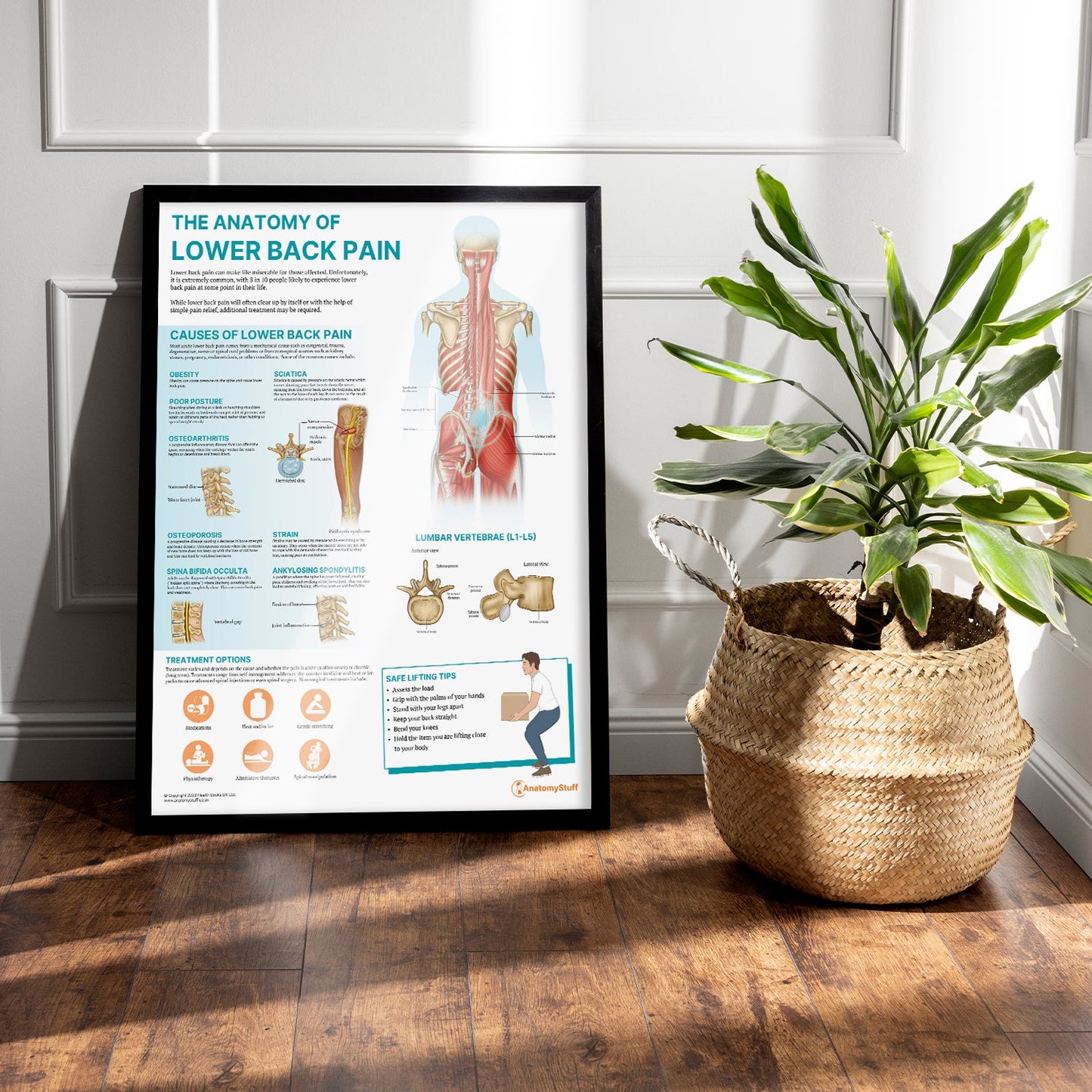 The Anatomy of Lower Back Pain Chart / Poster - Part of Collection