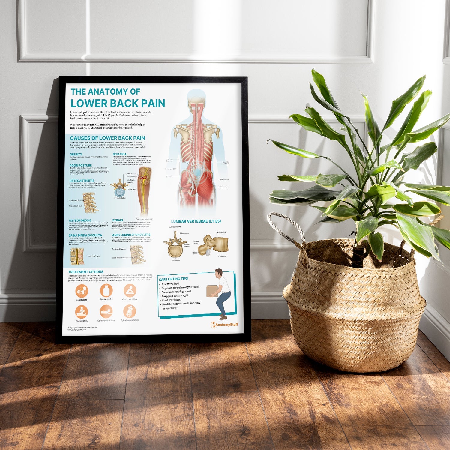 The Anatomy of Lower Back Pain Chart / Poster - Part of Collection