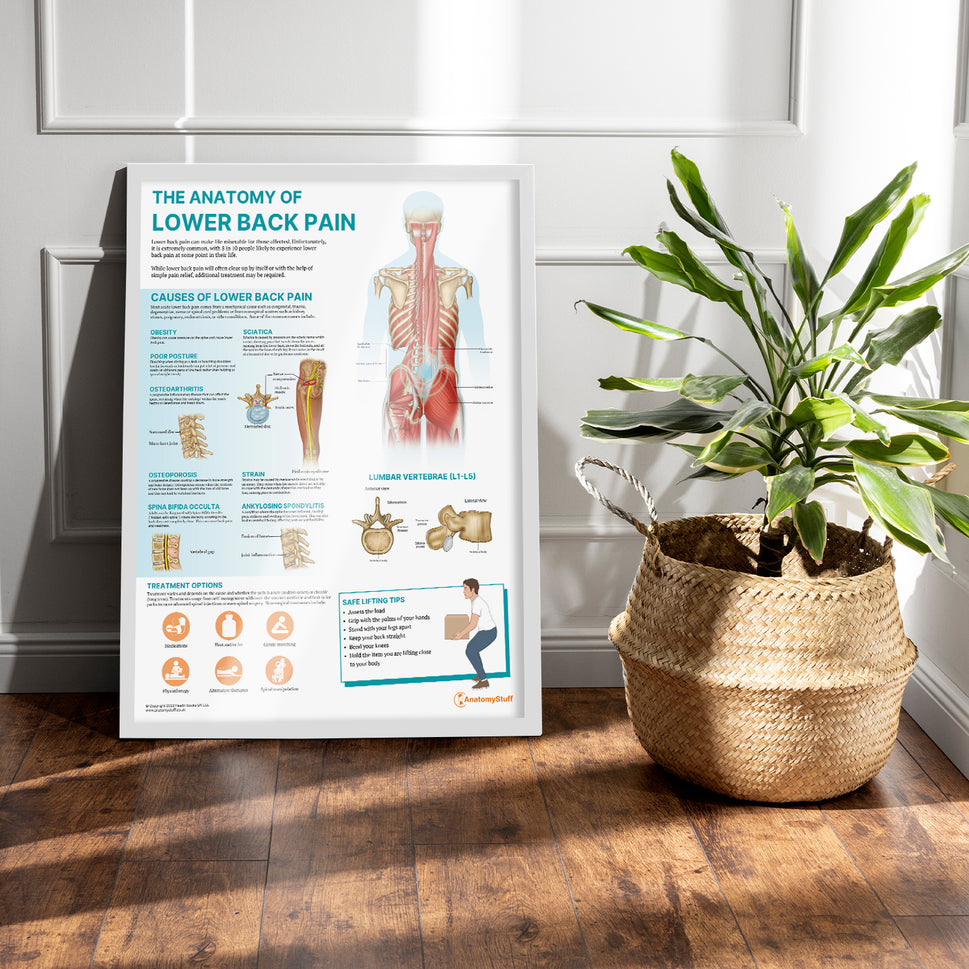 The Anatomy of Lower Back Pain Chart / Poster