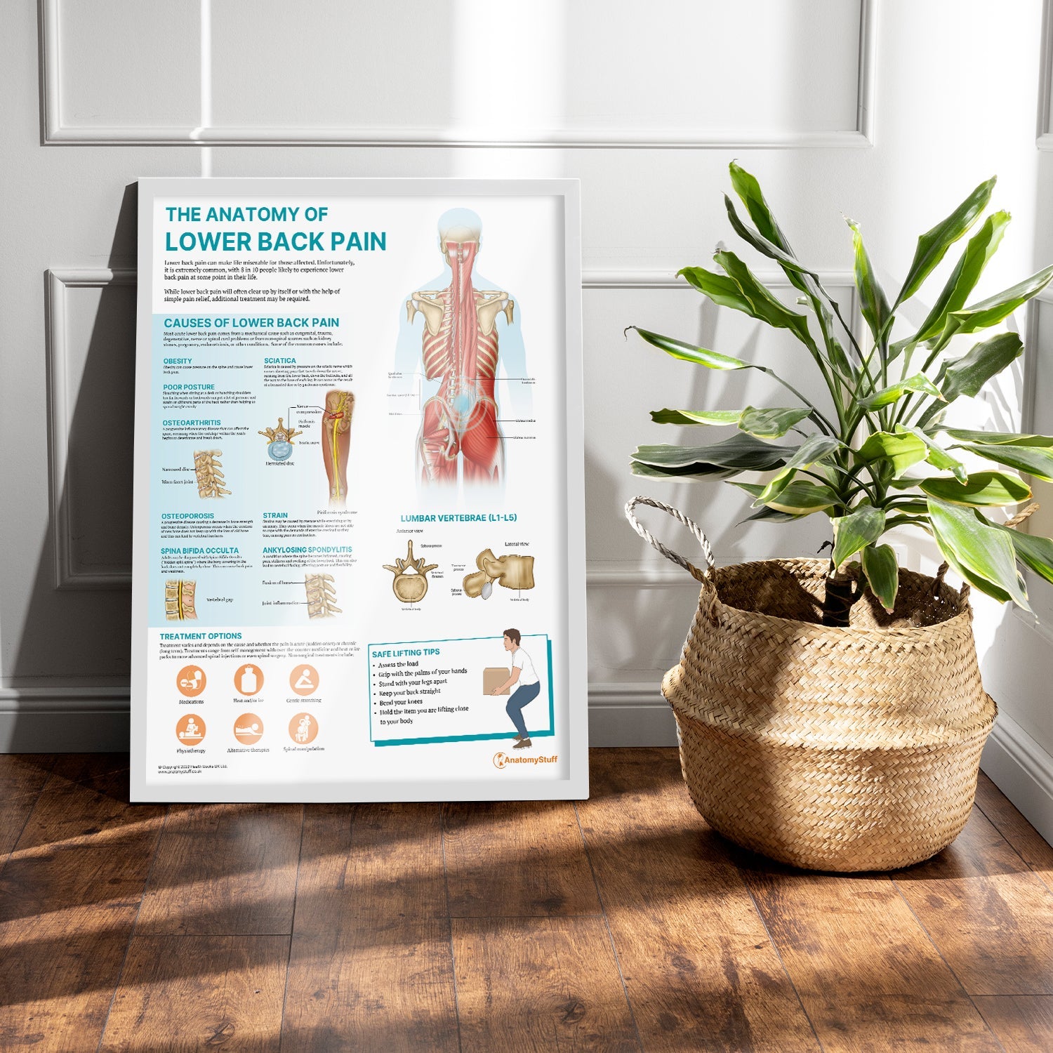 The Anatomy of Lower Back Pain Chart / Poster - Part of Collection
