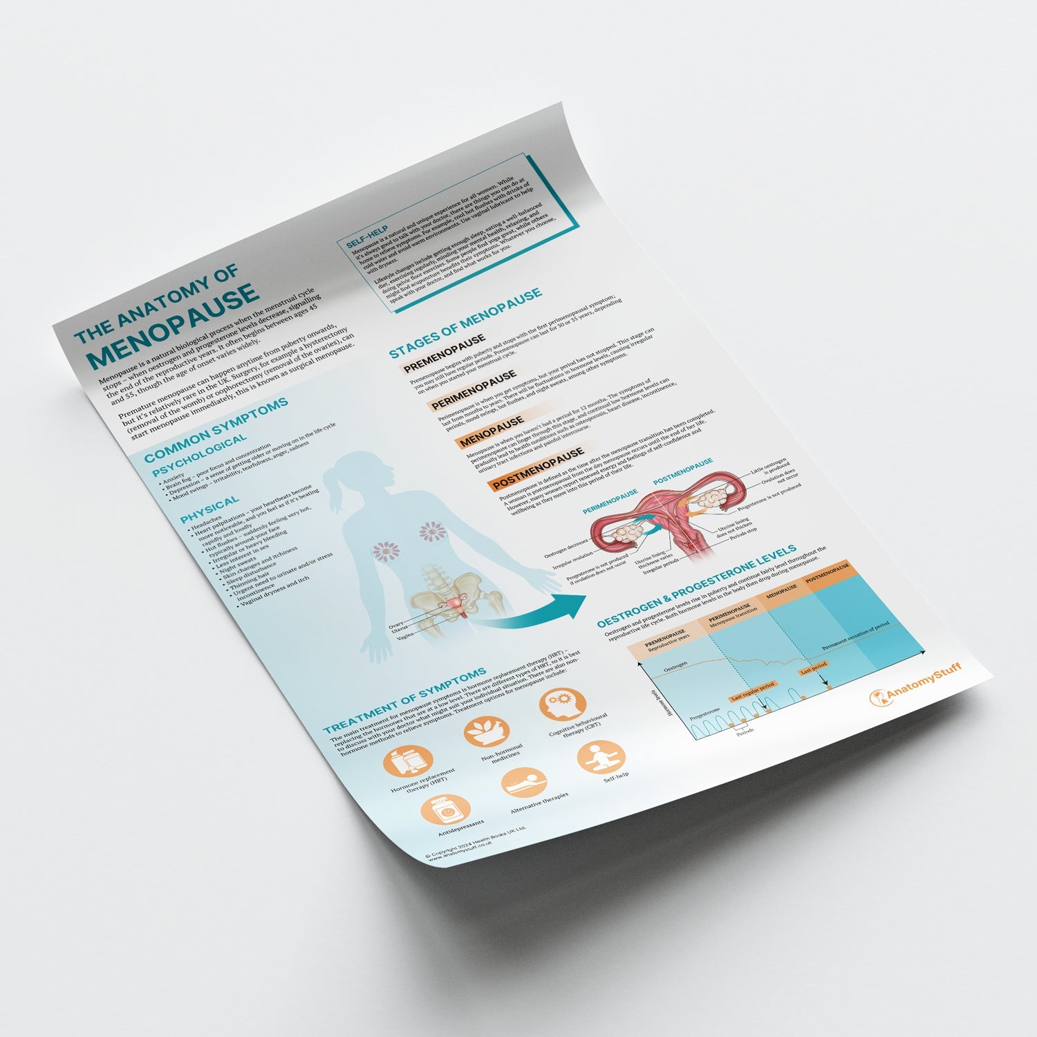 The Anatomy of Menopause Chart / Poster - Part of Collection