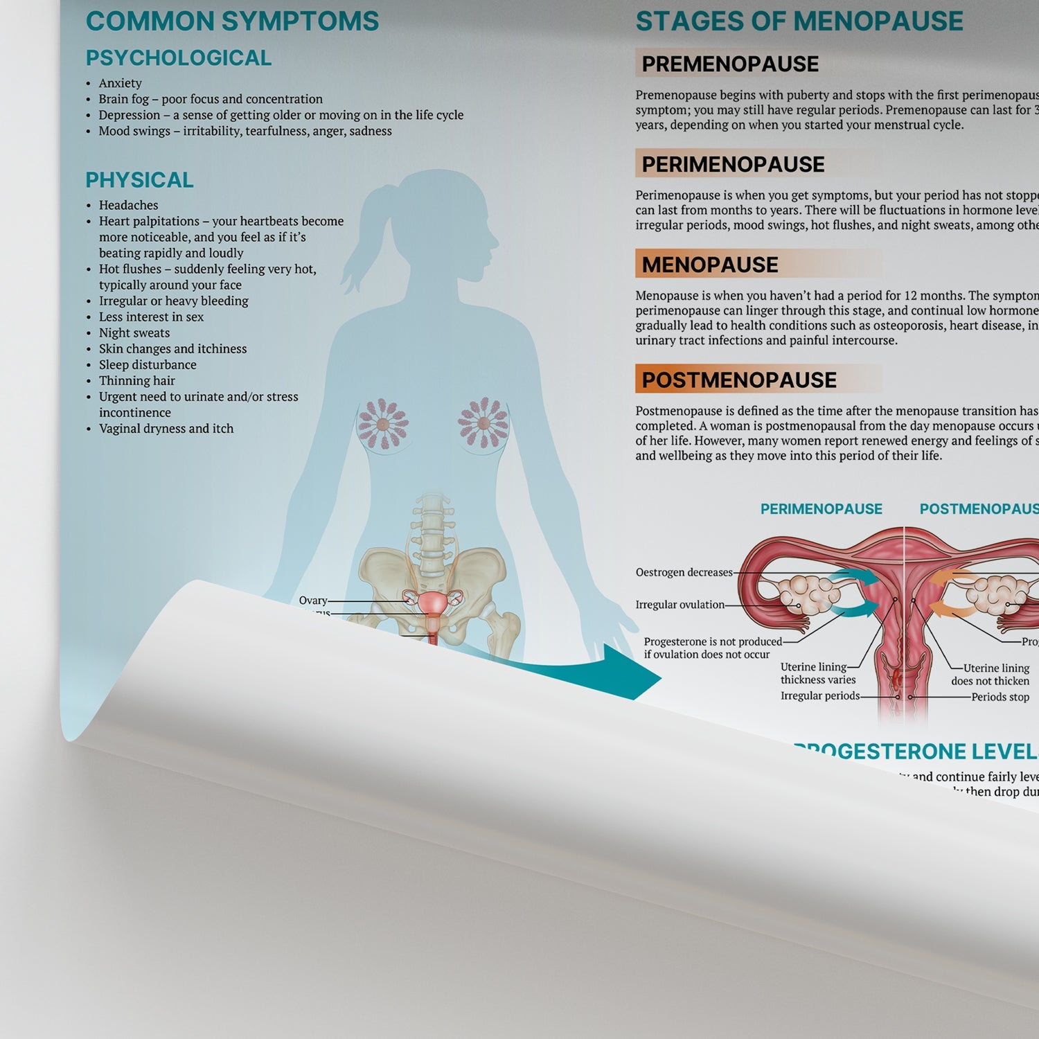 The Anatomy of Menopause Chart / Poster - Part of Collection