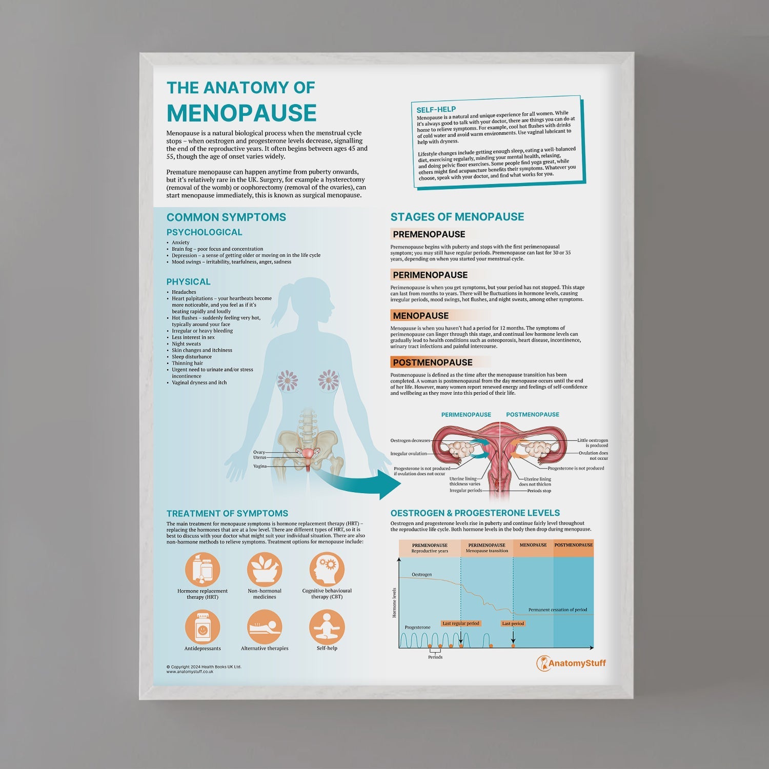 The Anatomy of Menopause Chart / Poster - Part of Collection