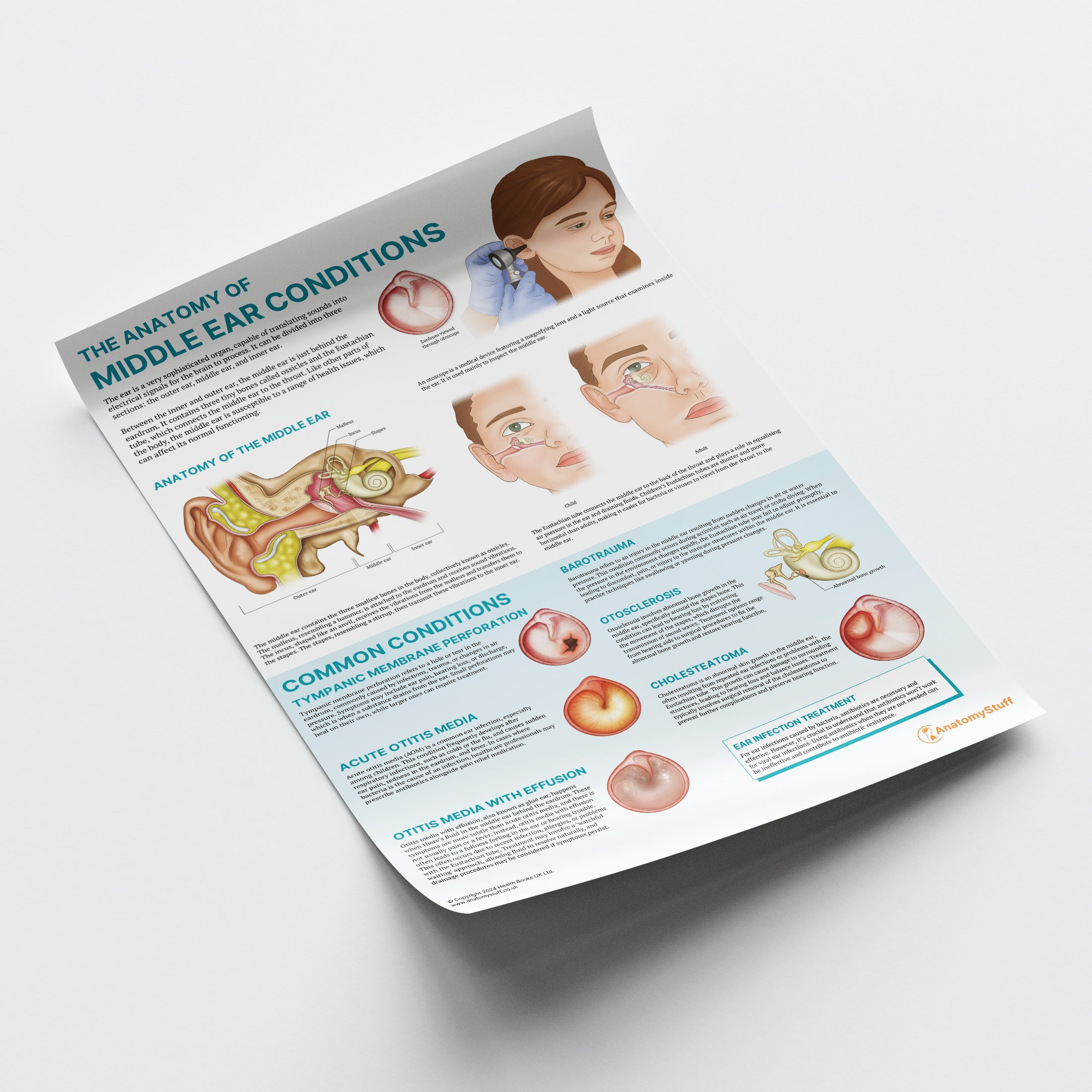 Tabella Anatomica Condizioni Orecchio Medio – Poster Laminato 50x66 Cm, Made In USA