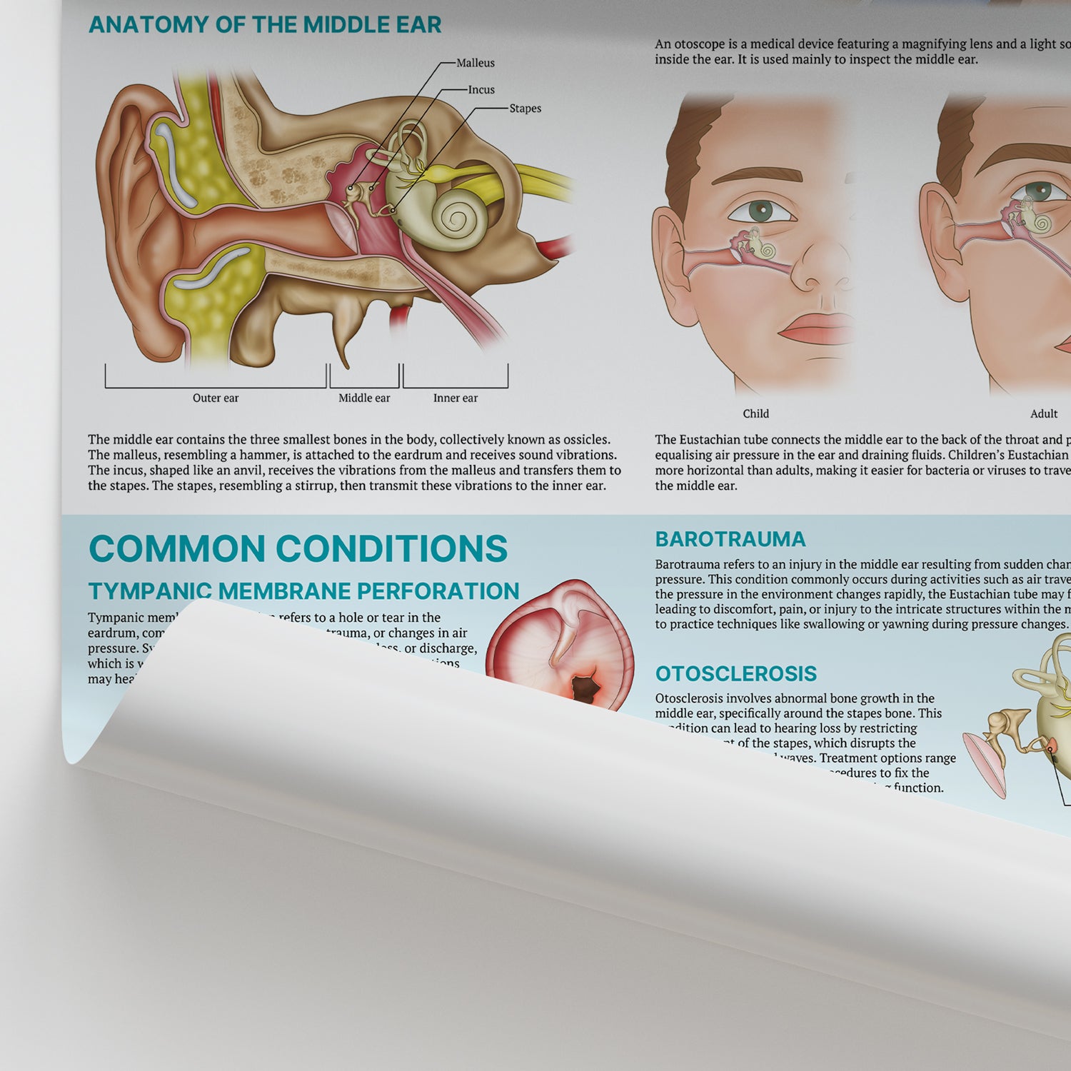 The Anatomy of Middle Ear Conditions Chart / Poster - | AnatomyStuff