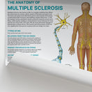 Switch The Anatomy of Multiple Sclerosis Chart / Poster 2 image
