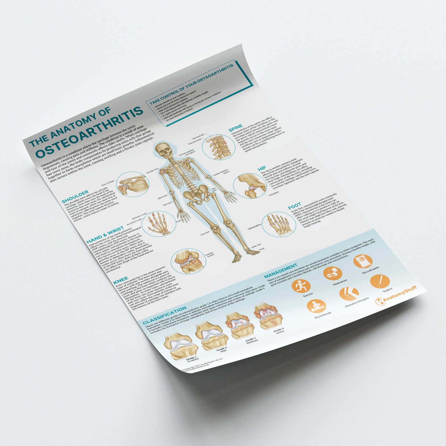 The Anatomy of Osteoarthritis Chart / Poster