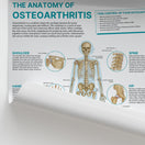 Switch The Anatomy of Osteoarthritis Chart / Poster 2 image