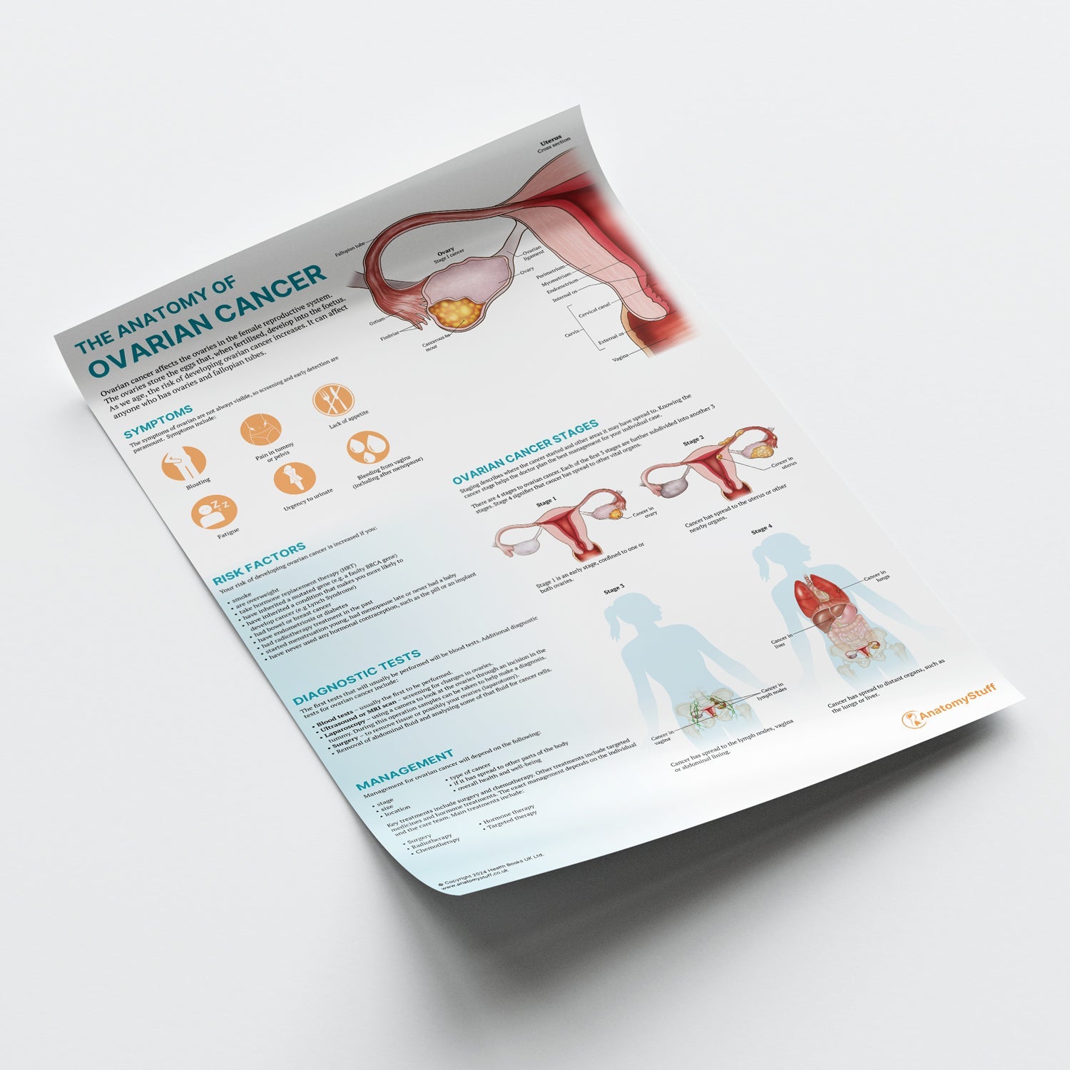 The Anatomy of Ovarian Cancer Chart / Poster - Part of Collection