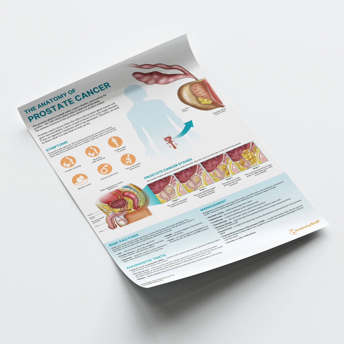The Anatomy of Prostate Cancer Chart / Poster