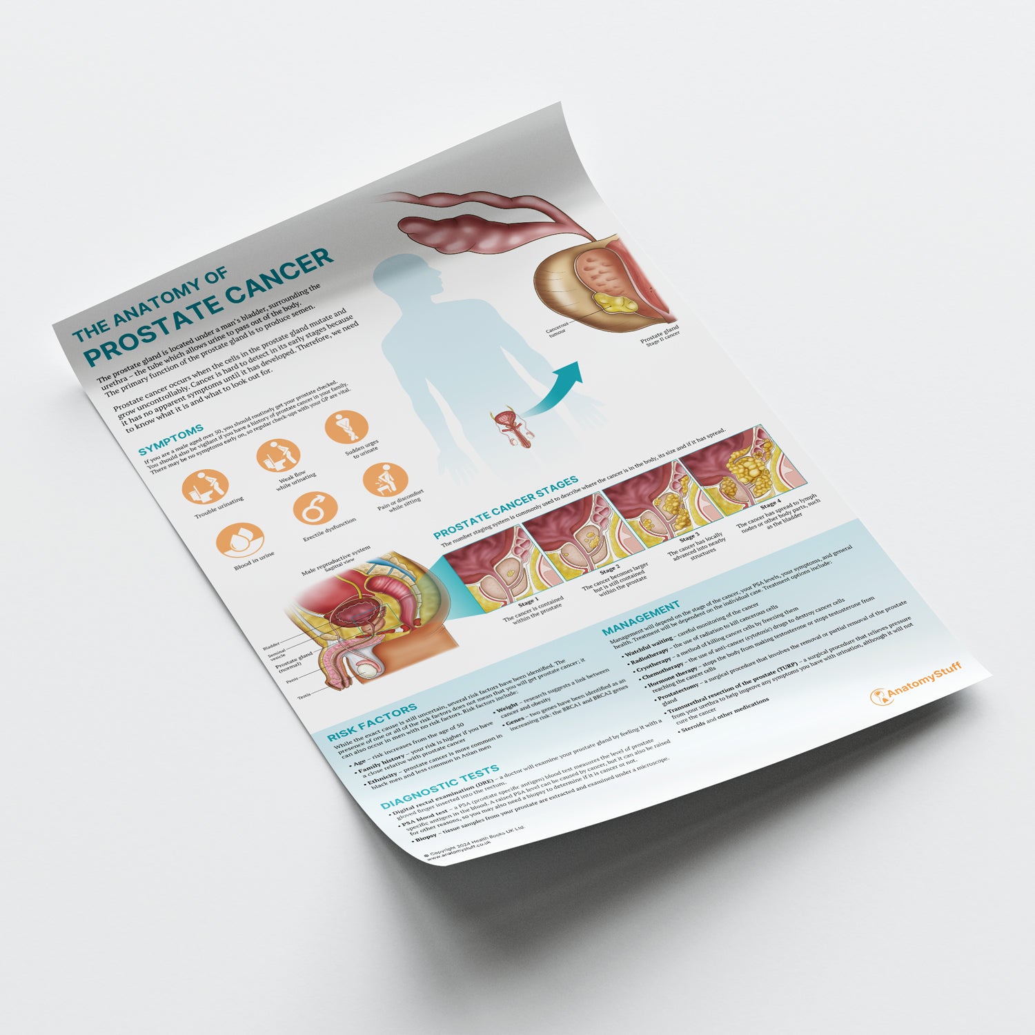 The Anatomy of Prostate Cancer Chart / Poster