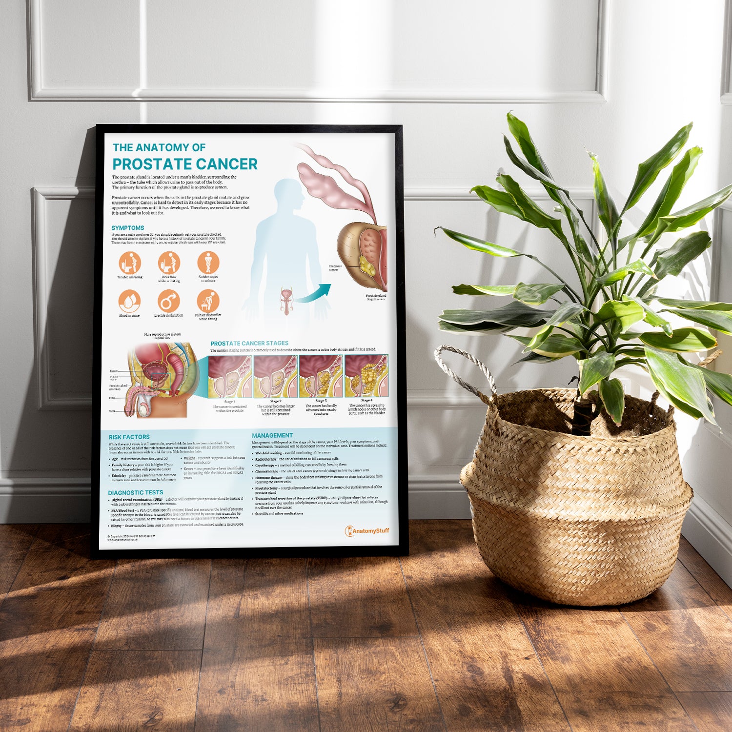 The Anatomy of Prostate Cancer Chart / Poster