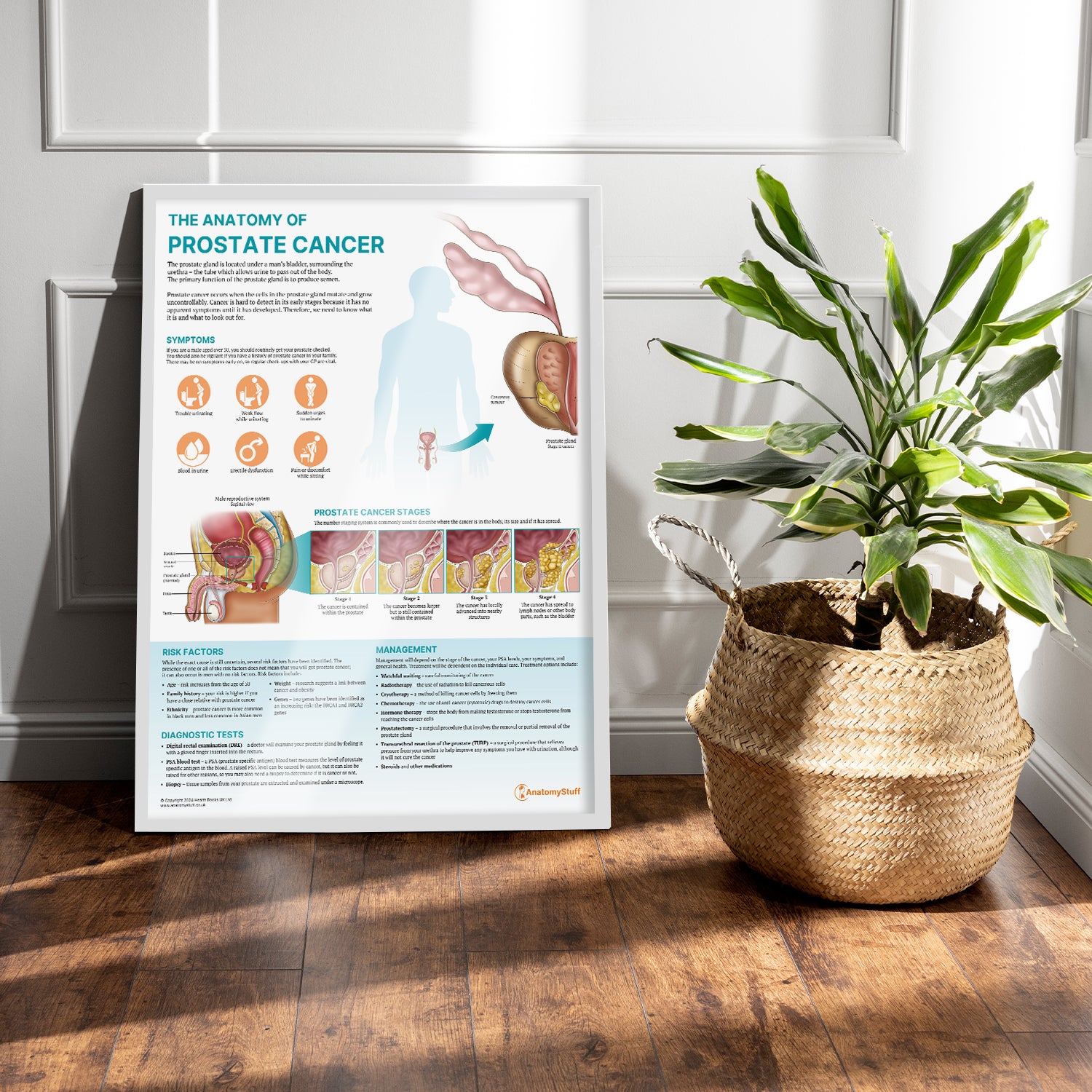 The Anatomy of Prostate Cancer Chart / Poster