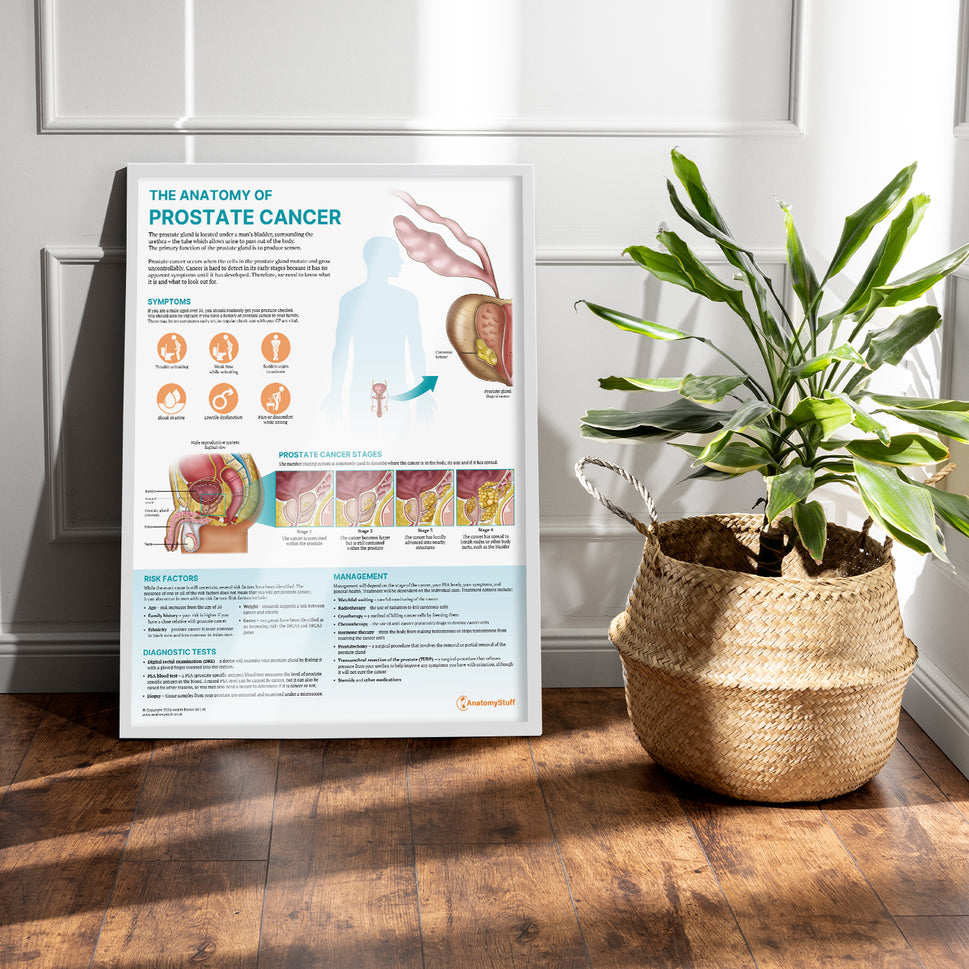 The Anatomy of Prostate Cancer Chart / Poster