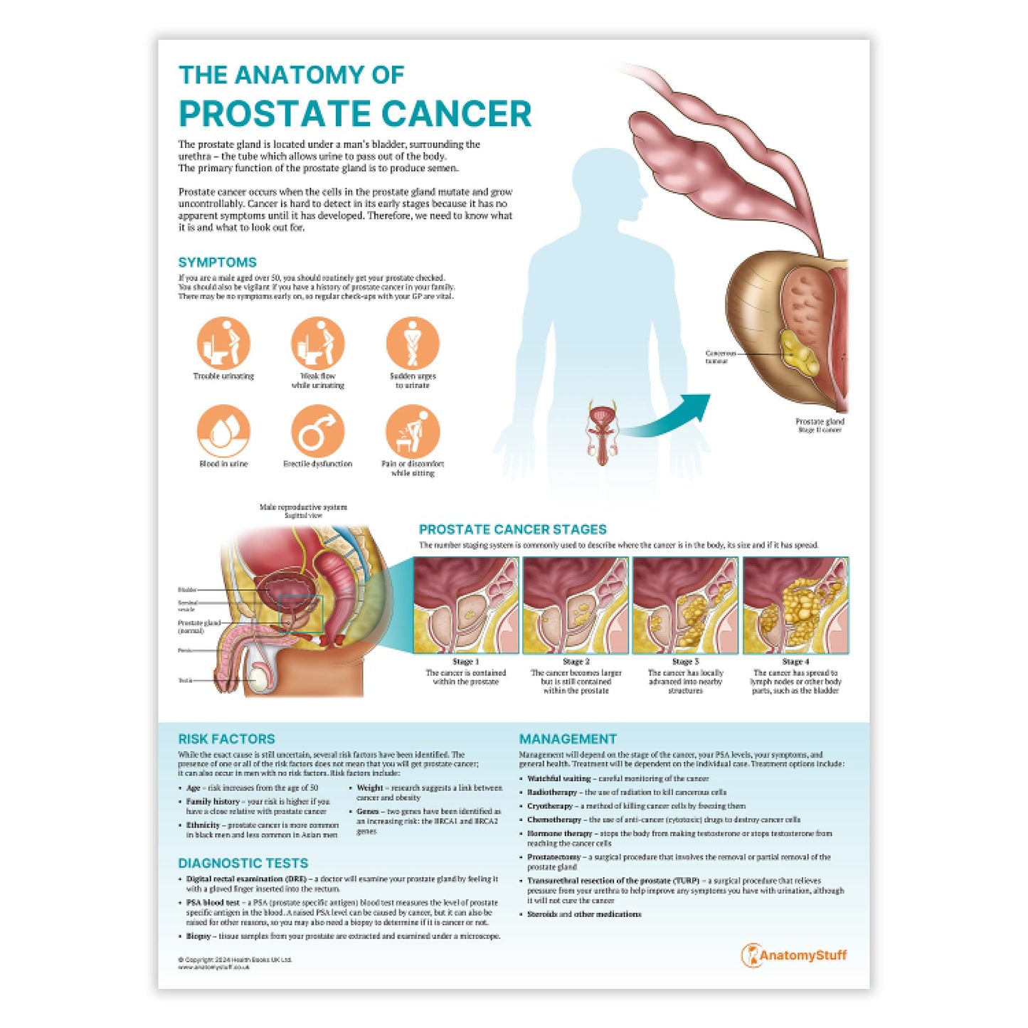 The Anatomy of Prostate Cancer Chart / Poster - Part of Collection
