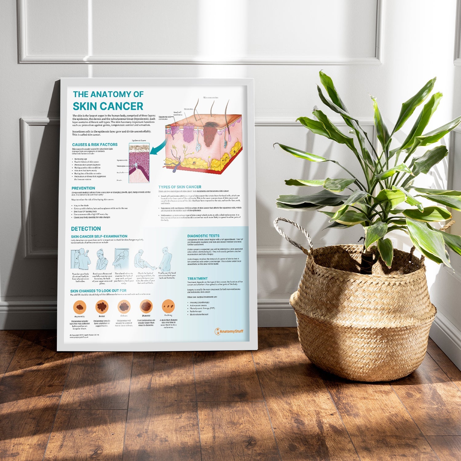 The Anatomy of Skin Cancer  Chart / Poster - Part of Collection