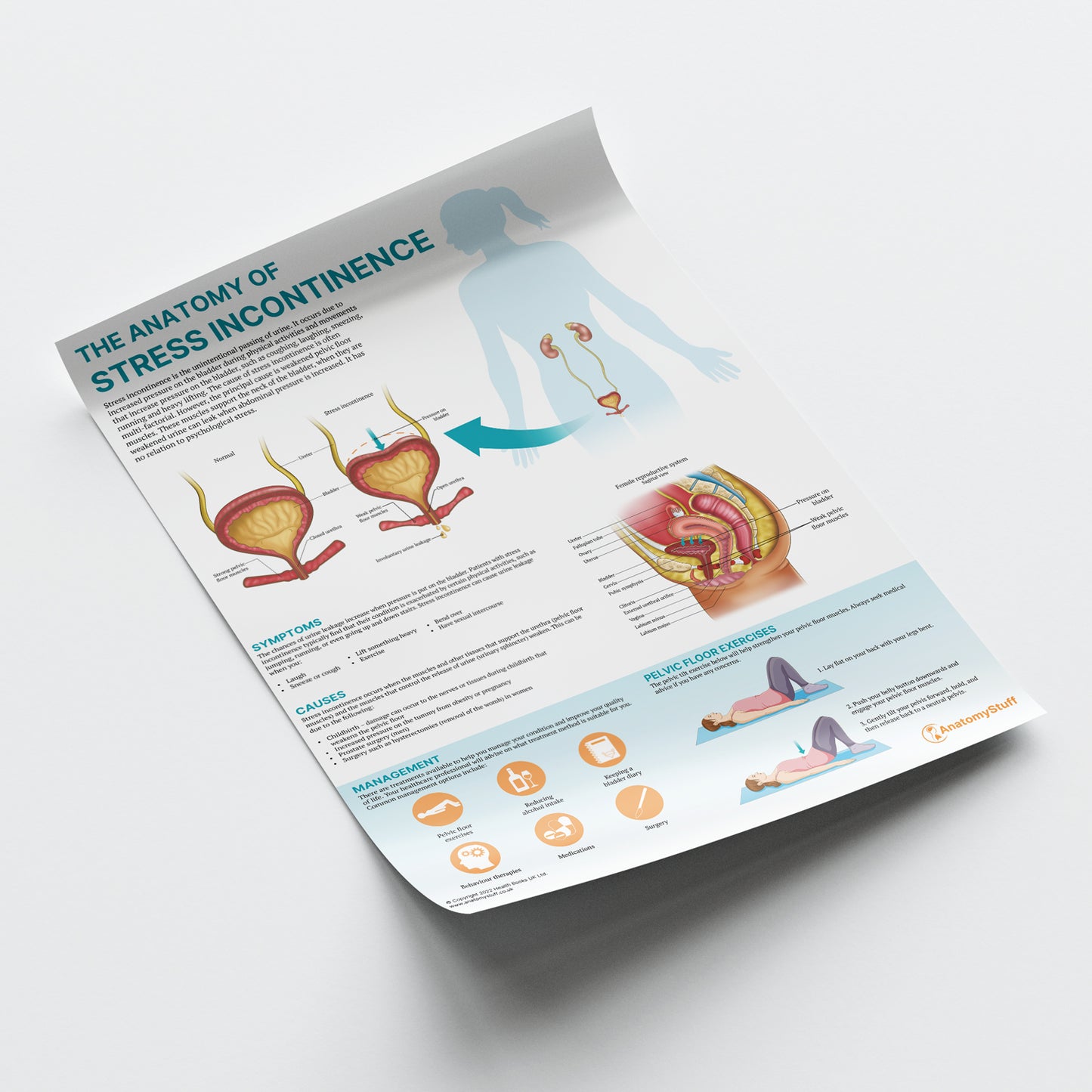 The Anatomy of Stress Incontinence Chart / Poster