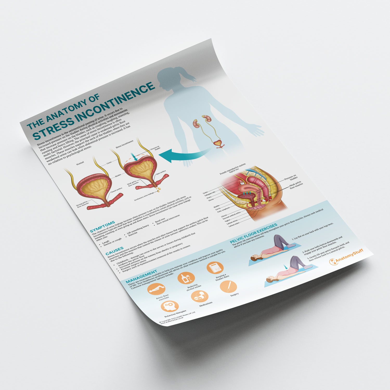 The Anatomy of Stress Incontinence Chart / Poster