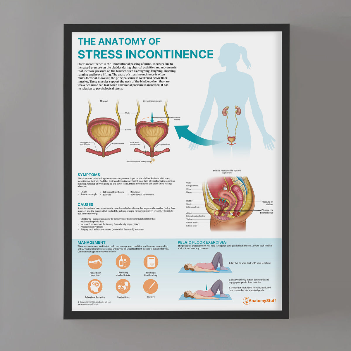 The Anatomy of Stress Incontinence | Urology Chart | Anatomy Stuff ...