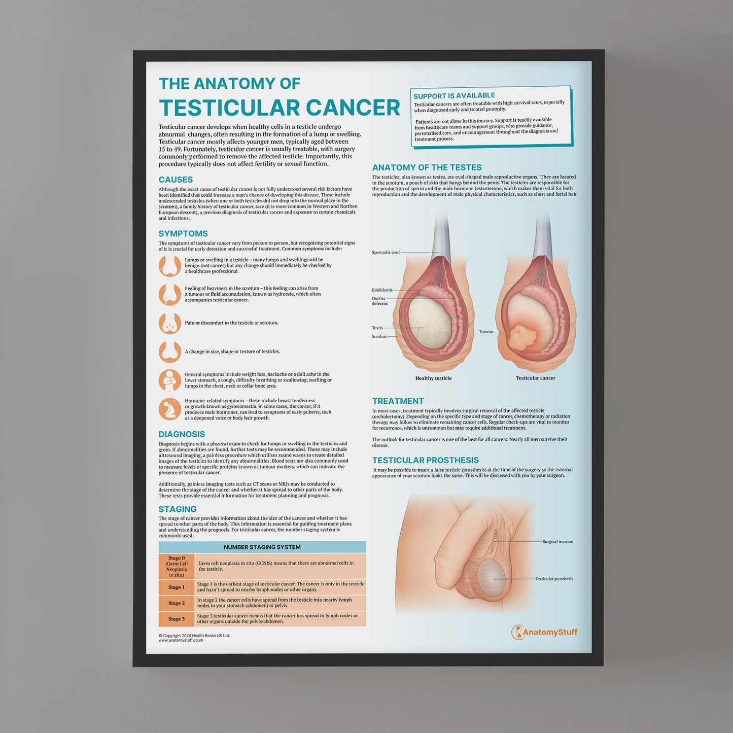 The Anatomy of Testicular Cancer Chart / Poster - Part of Collection