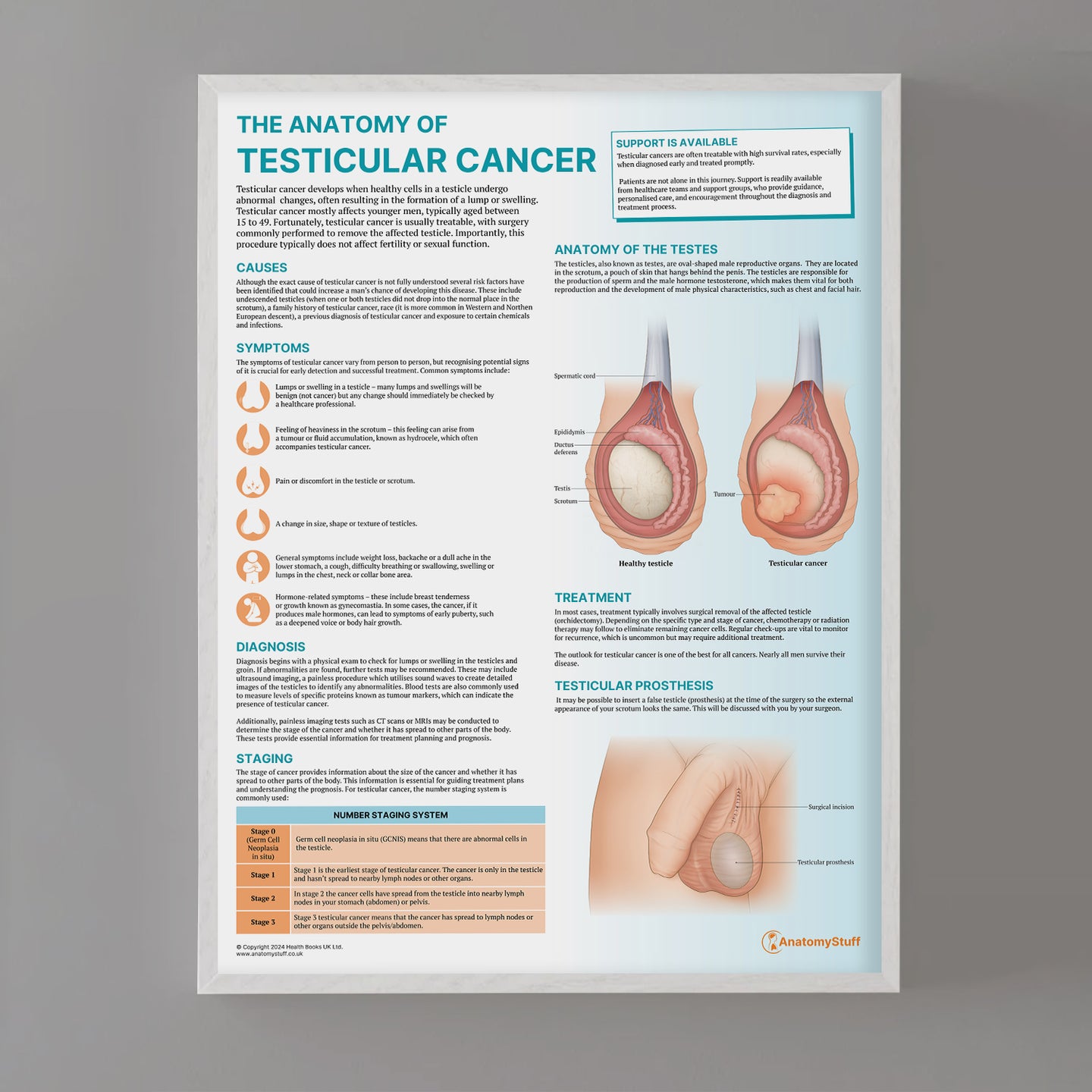 The Anatomy of Testicular Cancer Chart / Poster AnatomyStuff