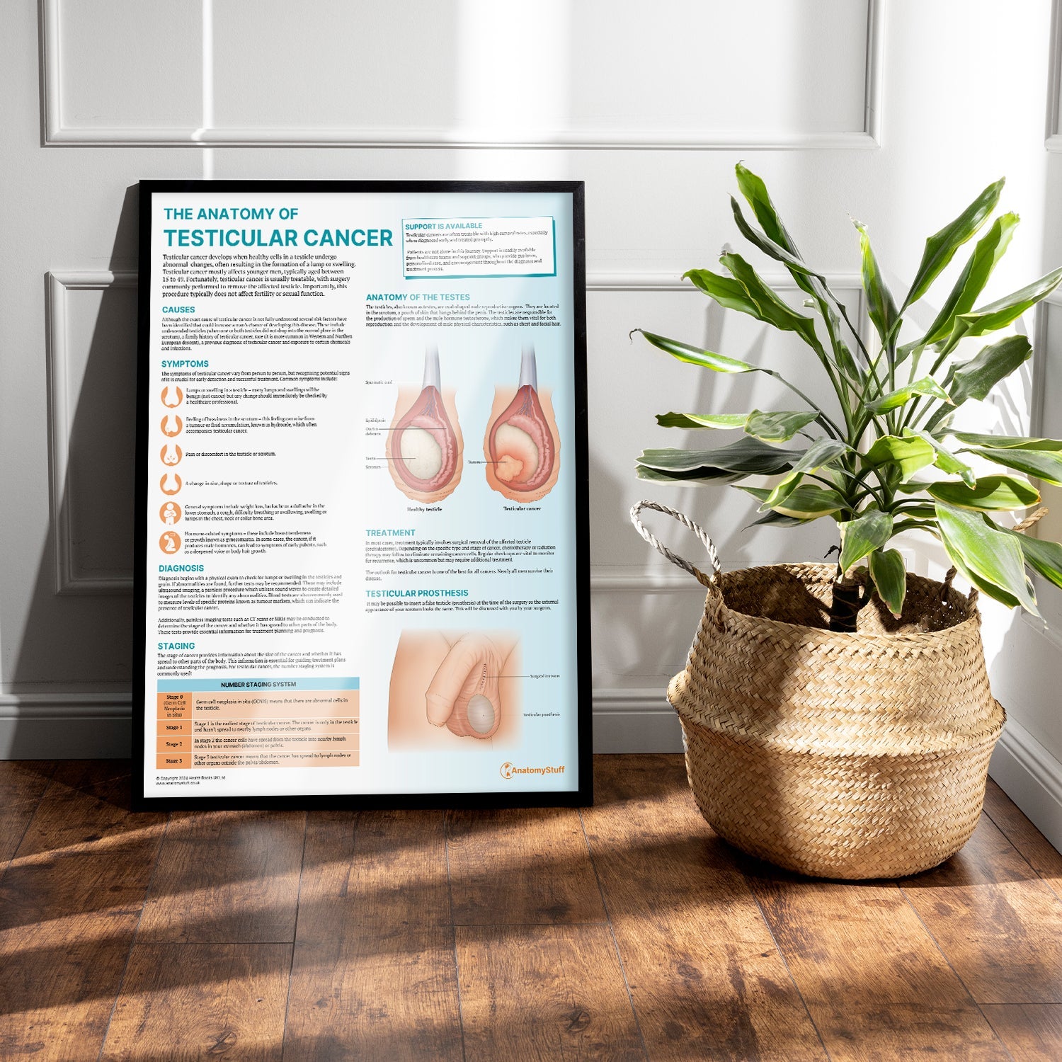 The Anatomy of Testicular Cancer Chart / Poster - Part of Collection