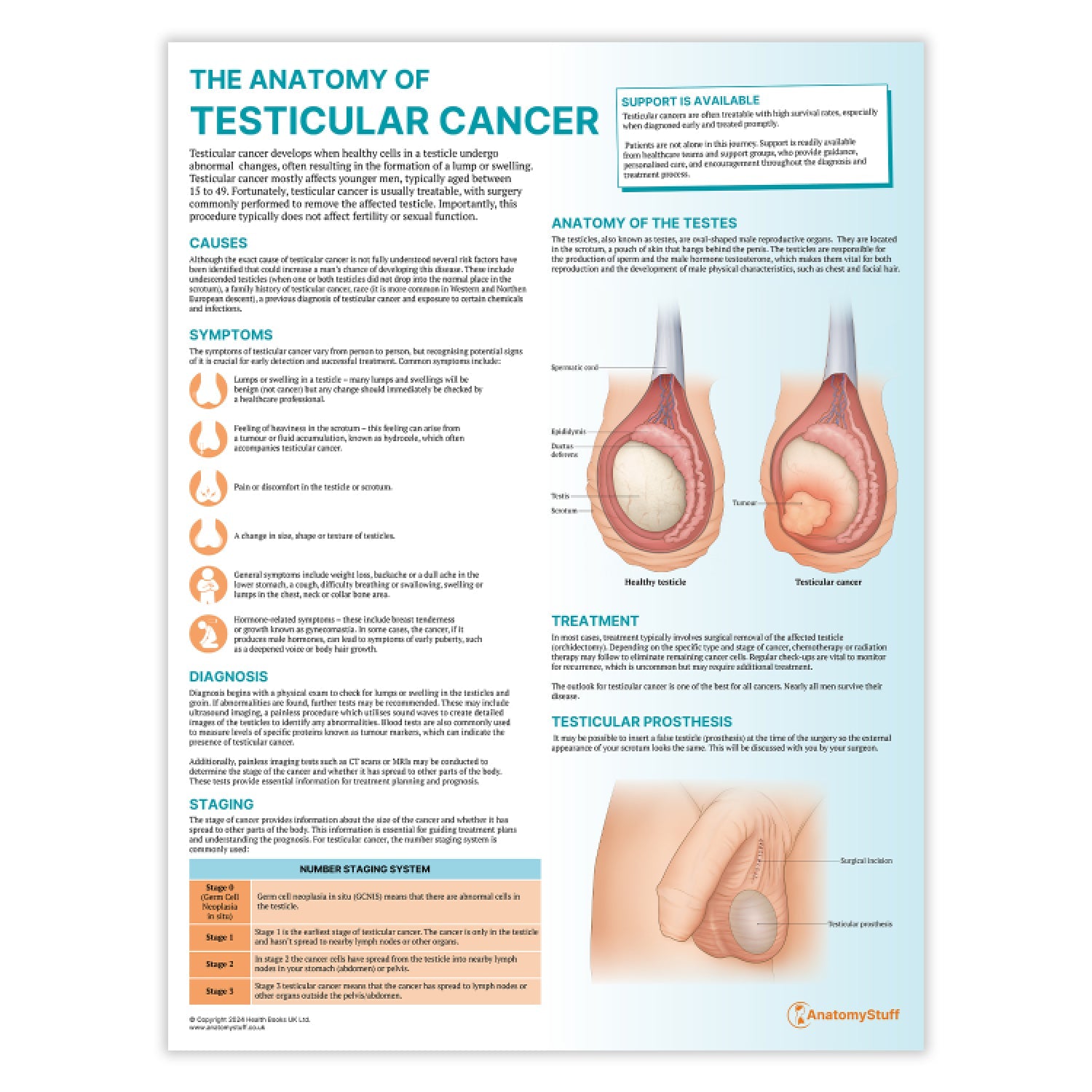 The Anatomy of Testicular Cancer Chart / Poster - Part of Collection