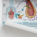 Switch The Anatomy of Type 1 Diabetes Chart / Poster 2 image