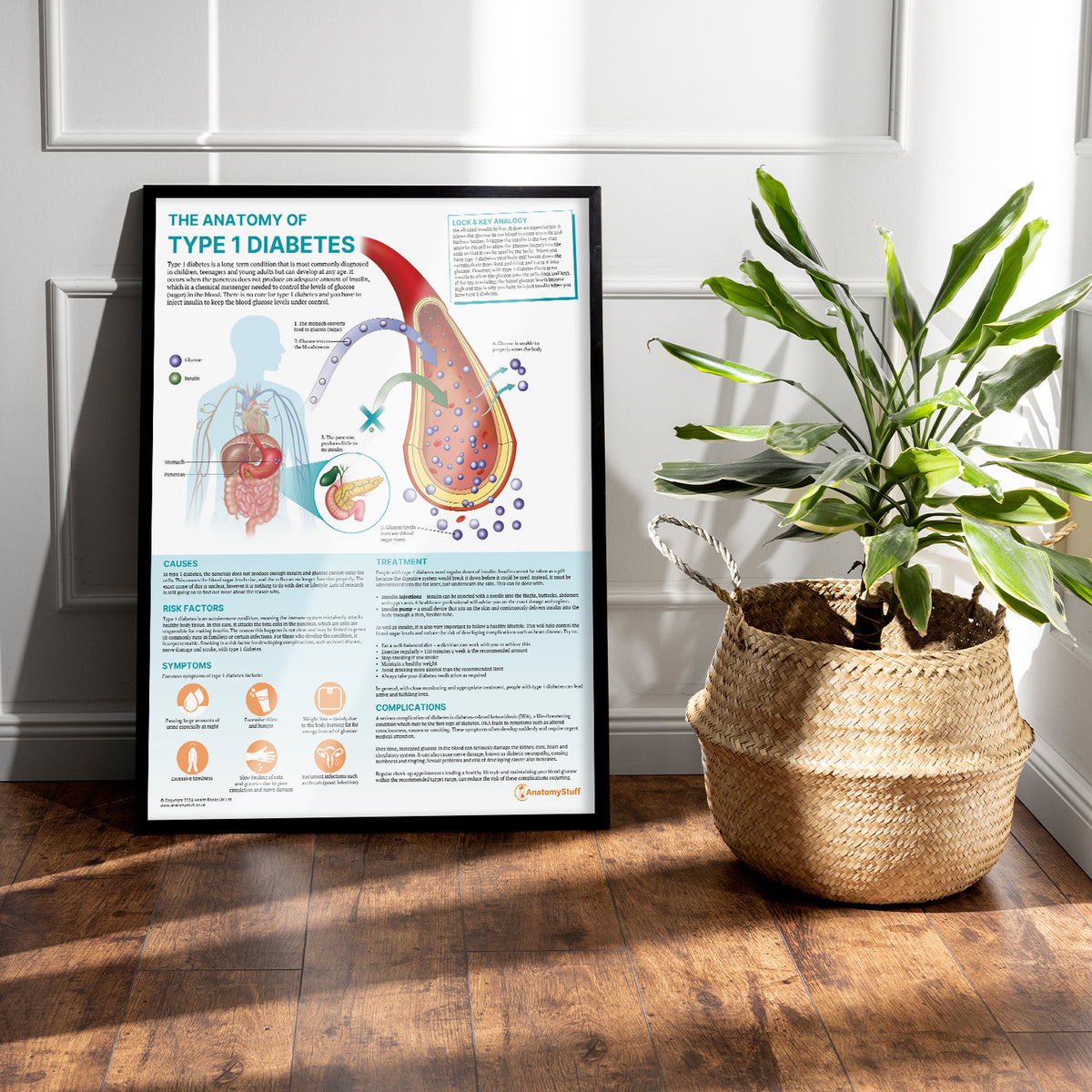 The Anatomy of Type 1 Diabetes Chart/Poster Laminated | Endocrine ...