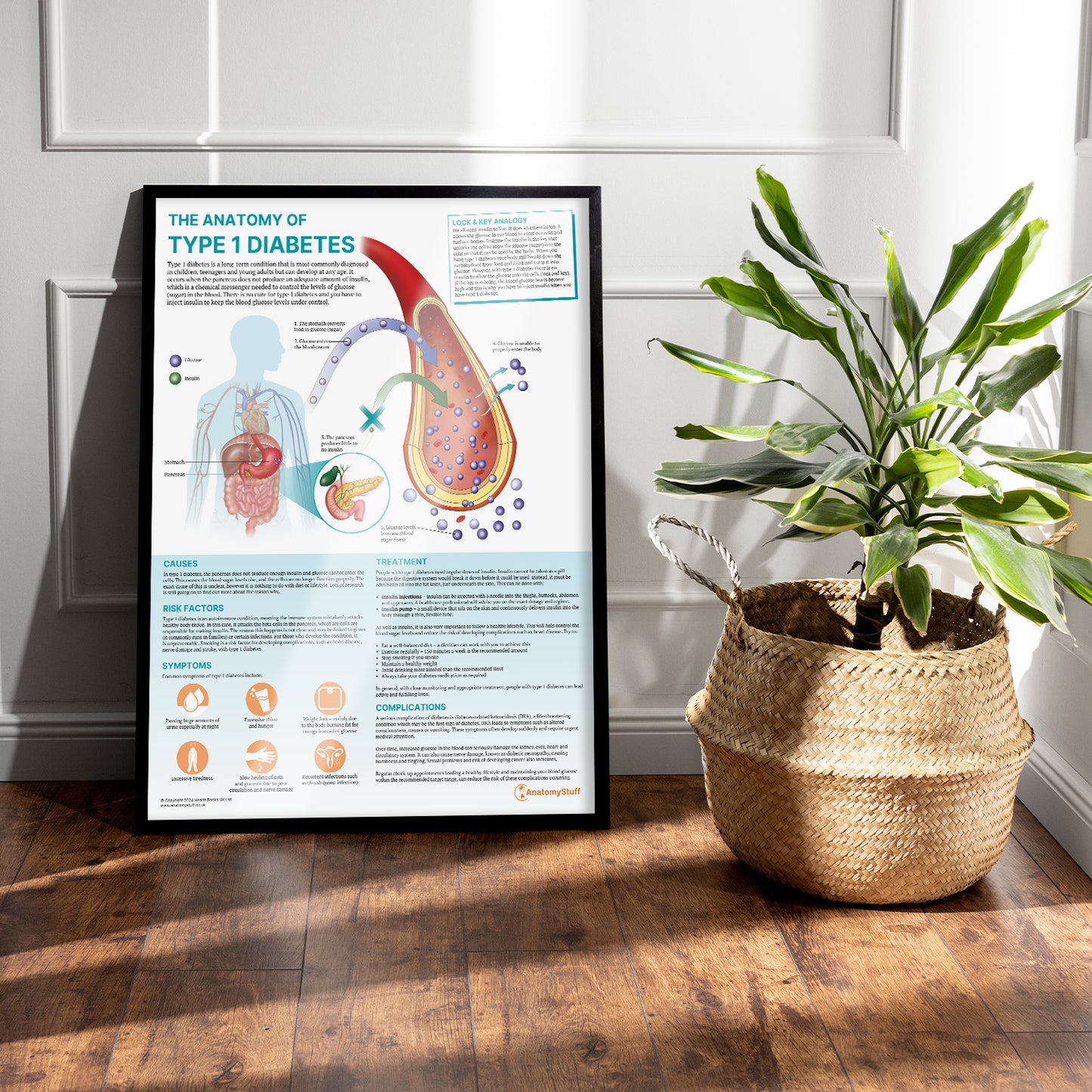 The Anatomy of Type 1 Diabetes Chart / Poster
