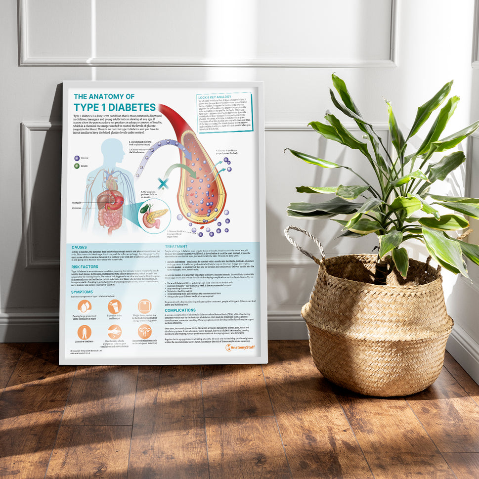 The Anatomy of Type 1 Diabetes Chart / Poster