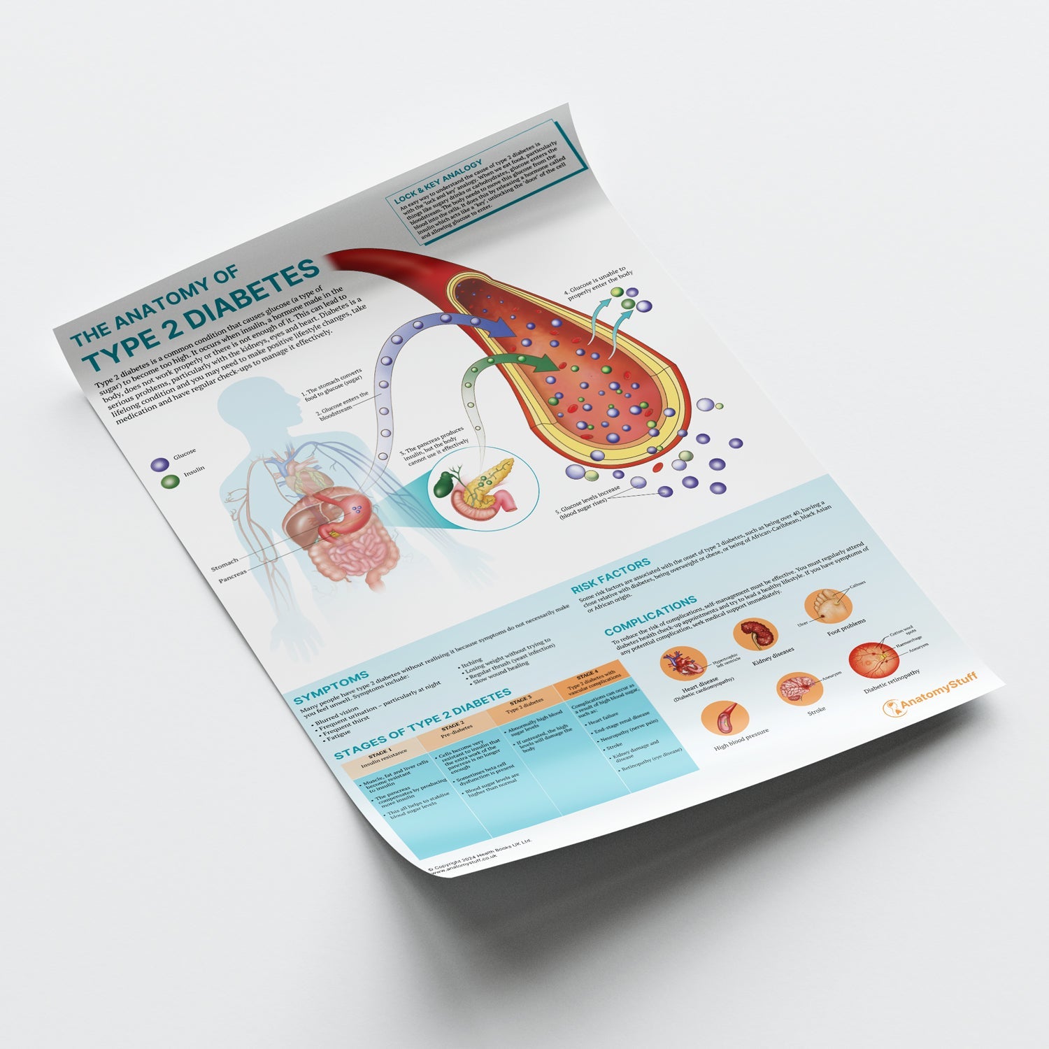The Anatomy of Type 2 Diabetes Chart / Poster - Part of Collection