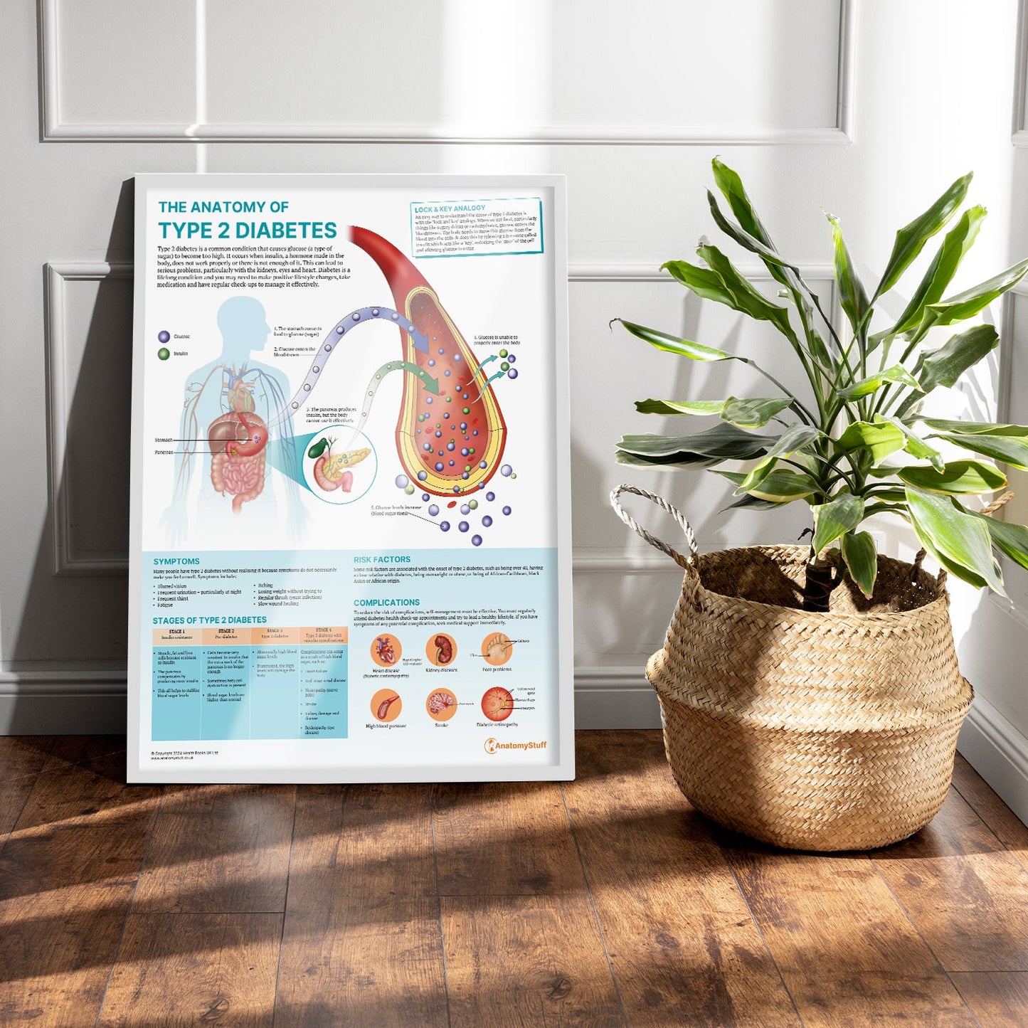 The Anatomy of Type 2 Diabetes Chart / Poster - Part of Collection