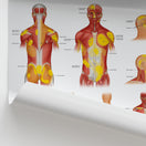 Switch Trigger Points: Head, Neck &amp; Trunk Chart / Poster 2 image