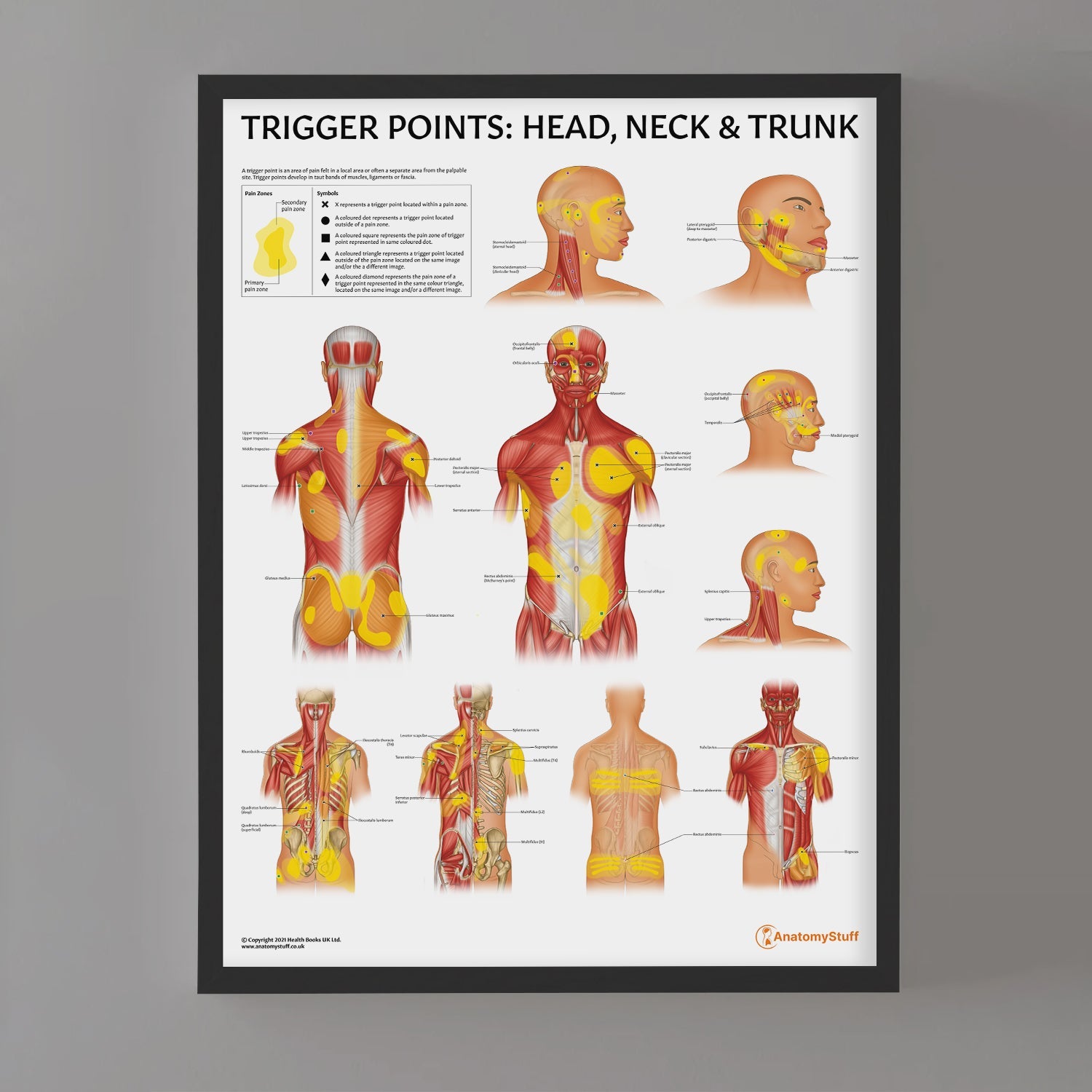 Trigger Points: Head, Neck & Trunk Chart / Poster - Part of Collection