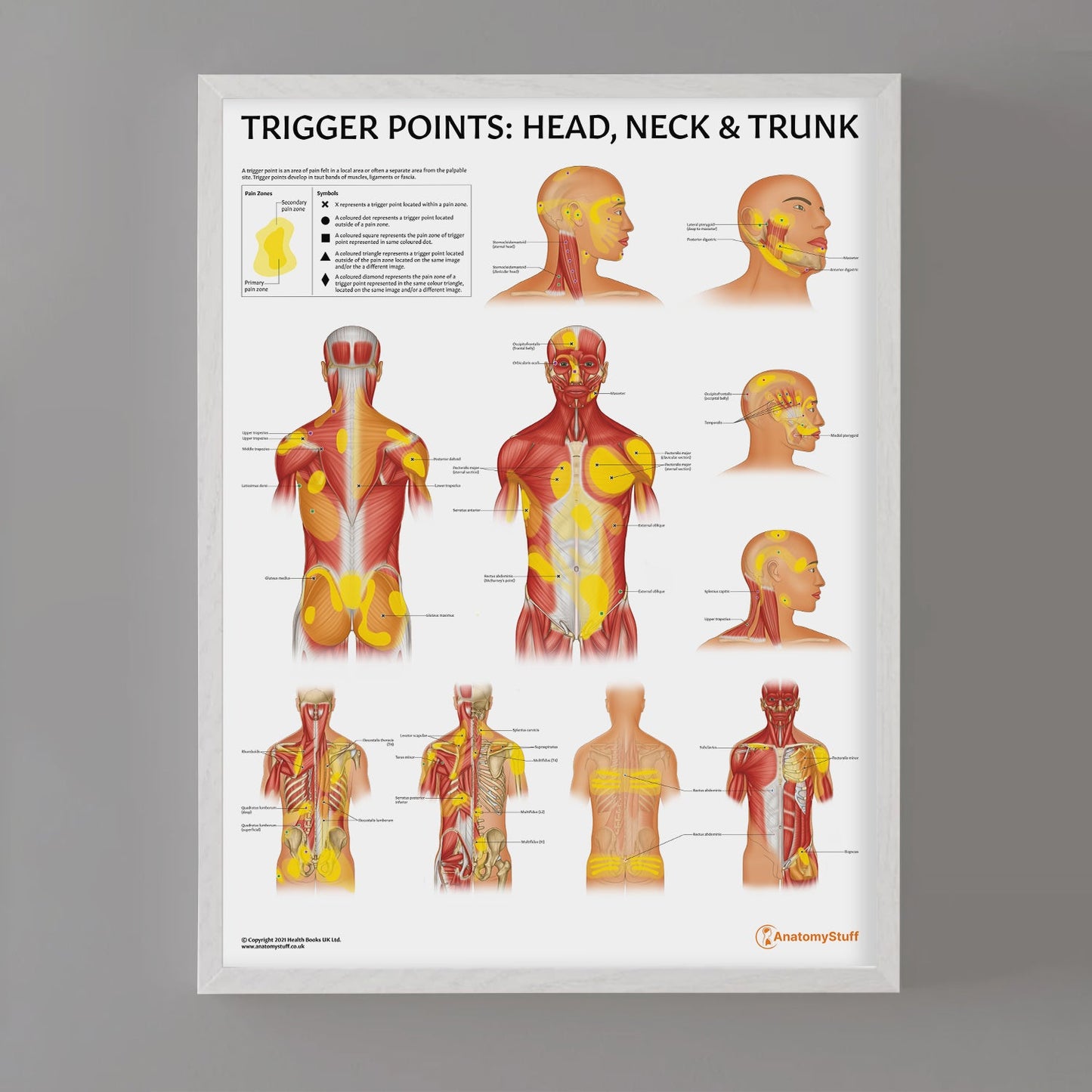 Trigger Points: Head, Neck & Trunk Chart / Poster - Part of Collection
