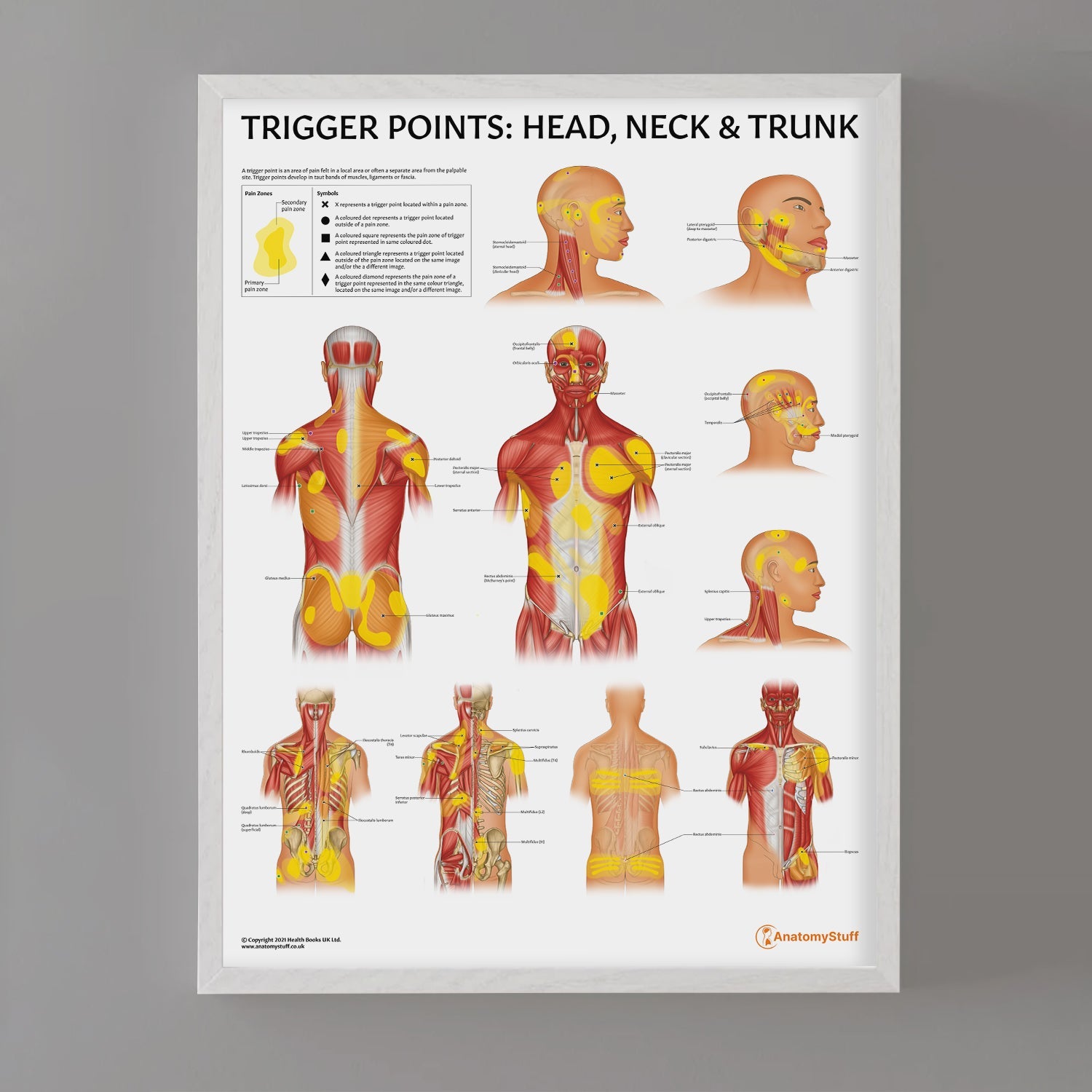 Trigger Points: Head, Neck & Trunk Chart / Poster - Part of Collection