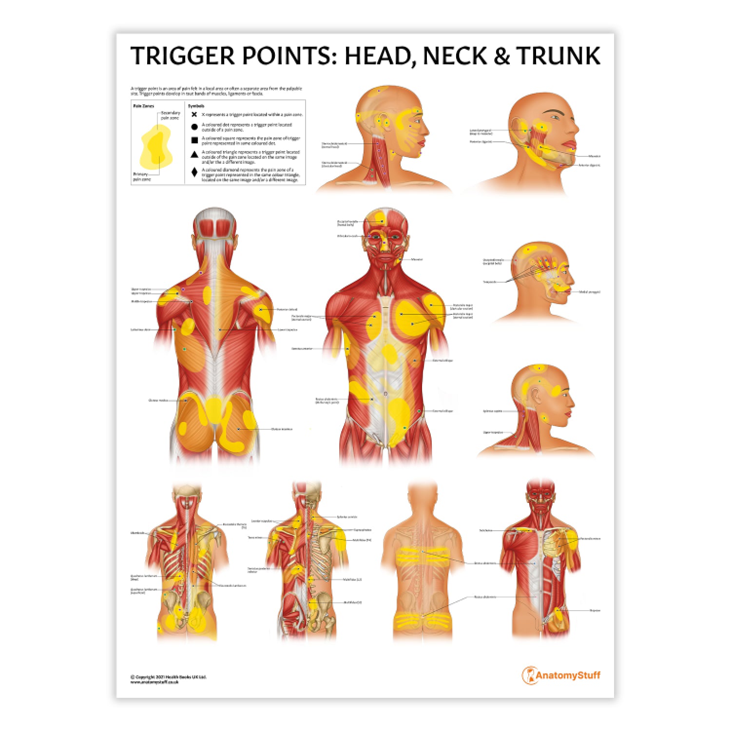 Trigger Points: Head, Neck & Trunk Chart / Poster