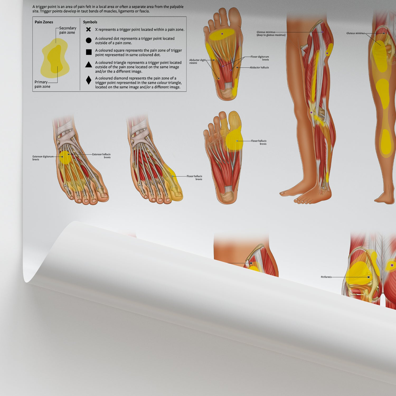 Trigger Points: Lower Extremities | Myofascial Pain Charts – AnatomyStuff