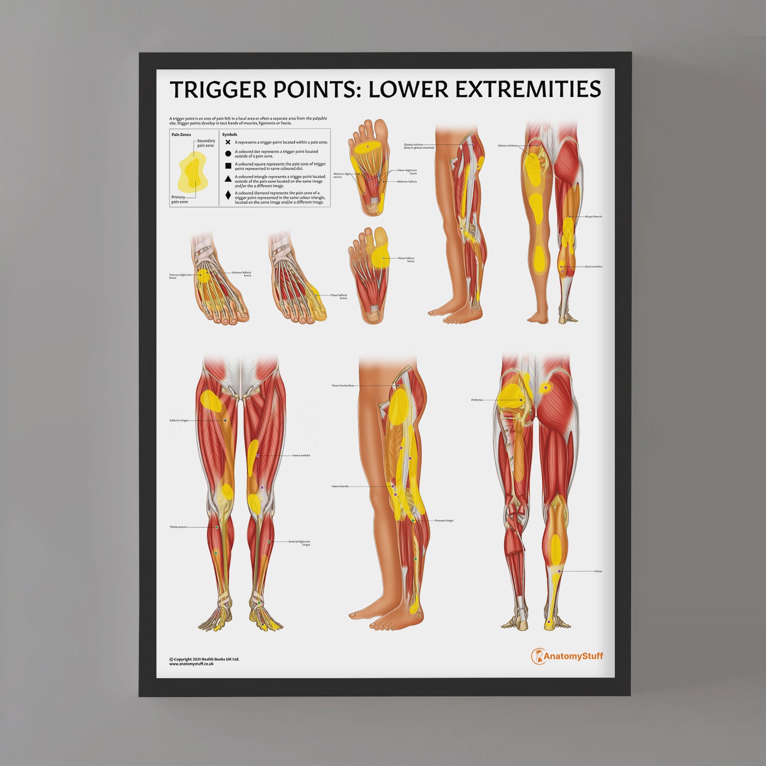 Trigger Points In Horses Horse Journals Trigger Points: Lower