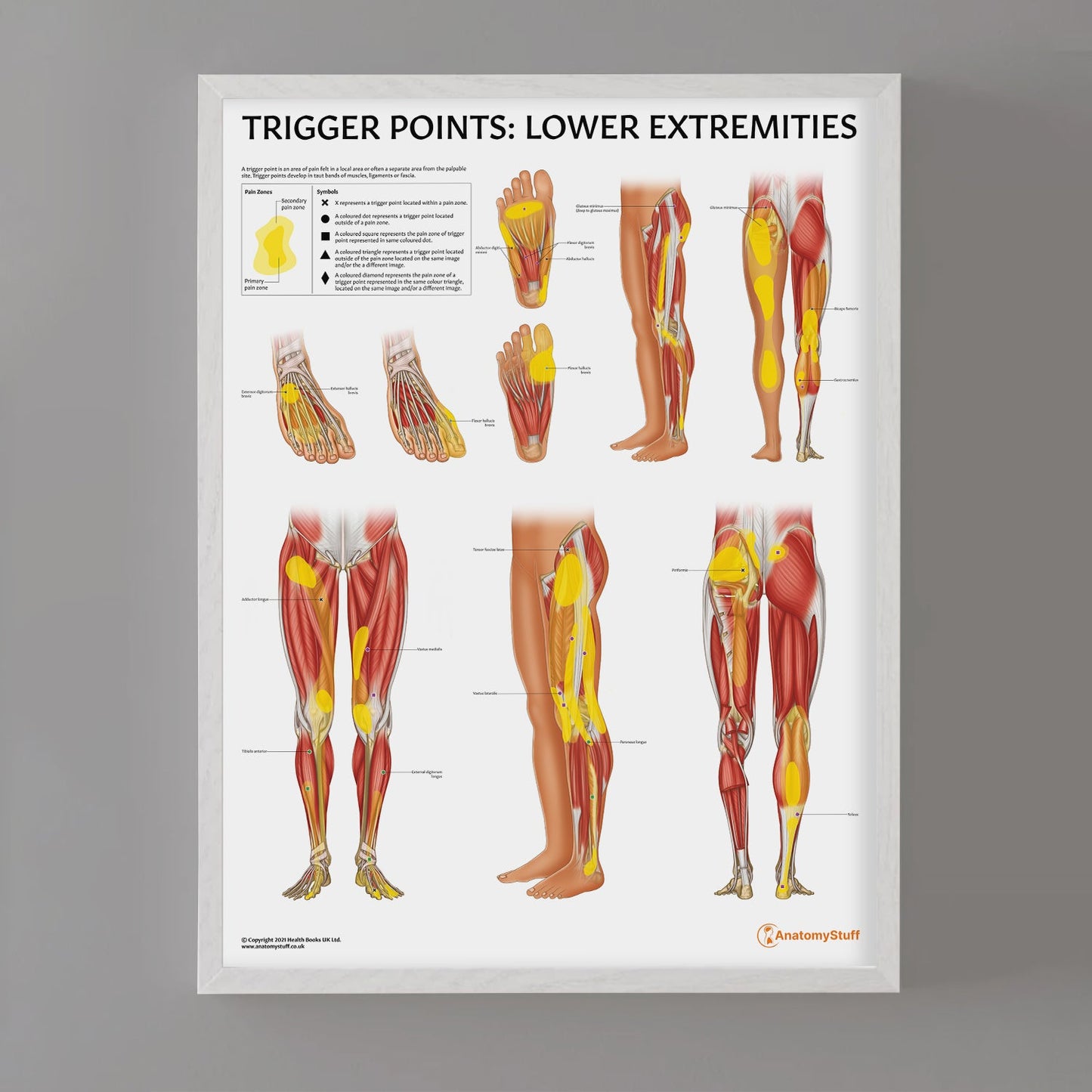 Trigger Points: Lower Extremities Chart / Poster - Part of Collection