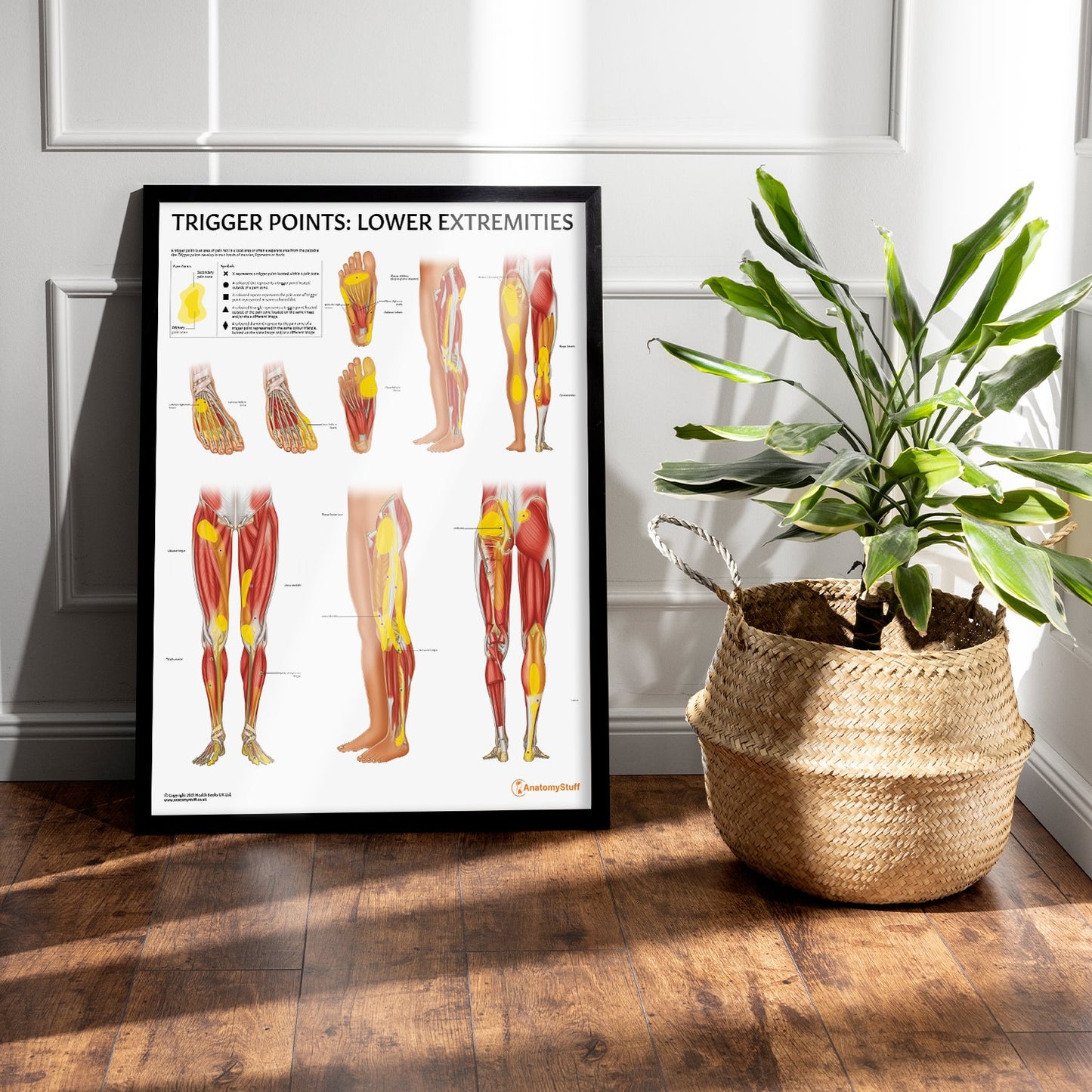 Trigger Points: Lower Extremities Chart / Poster - Part of Collection