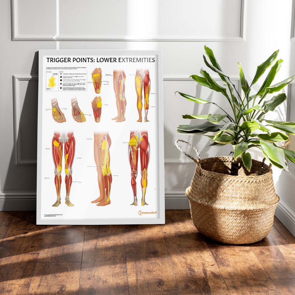 Trigger Points: Lower Extremities Chart / Poster