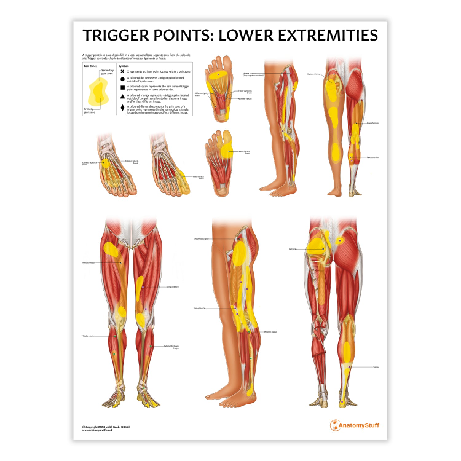 Trigger Points: Lower Extremities Chart / Poster