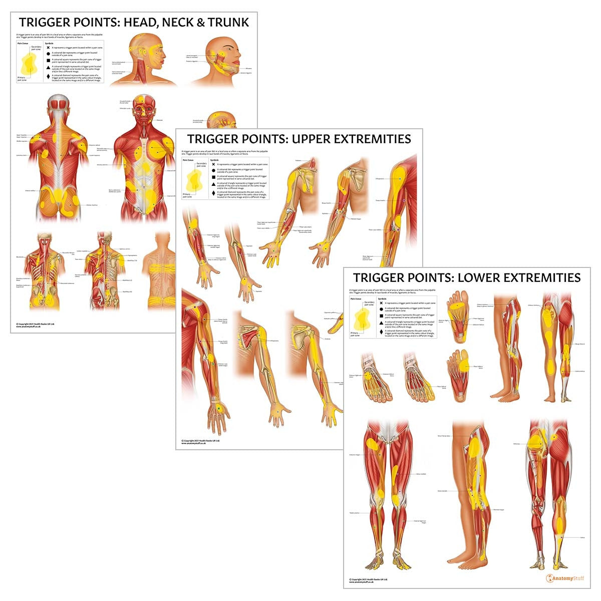 Trigger Points 3 Poster Collection
