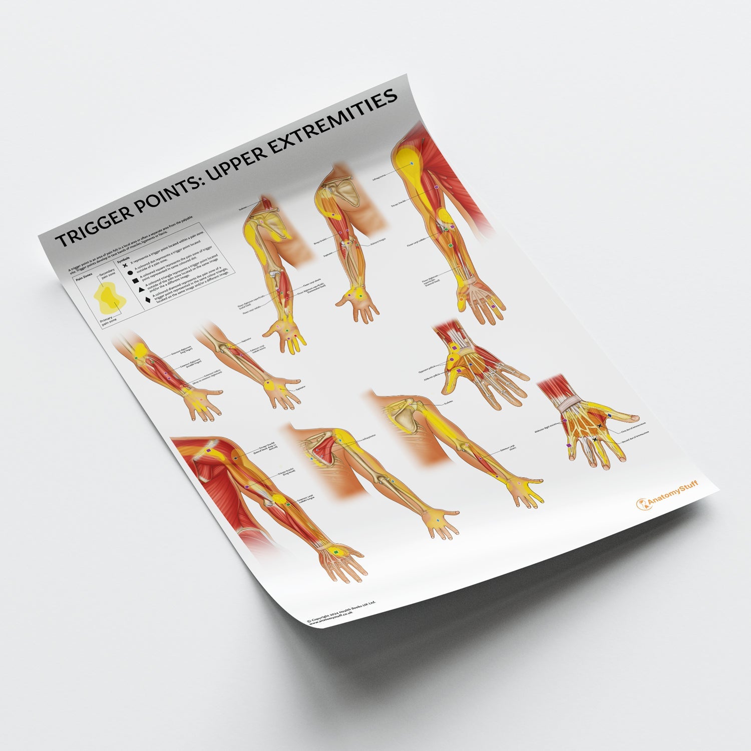Trigger Points: Upper Extremities Chart / Poster - Part of Collection