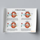 Switch Types of Vision (Printable PDF) 2 image