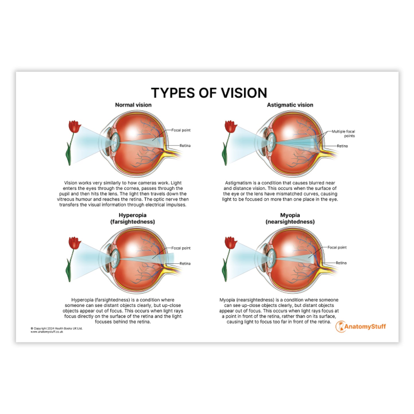 Types of Vision (Printable PDF)